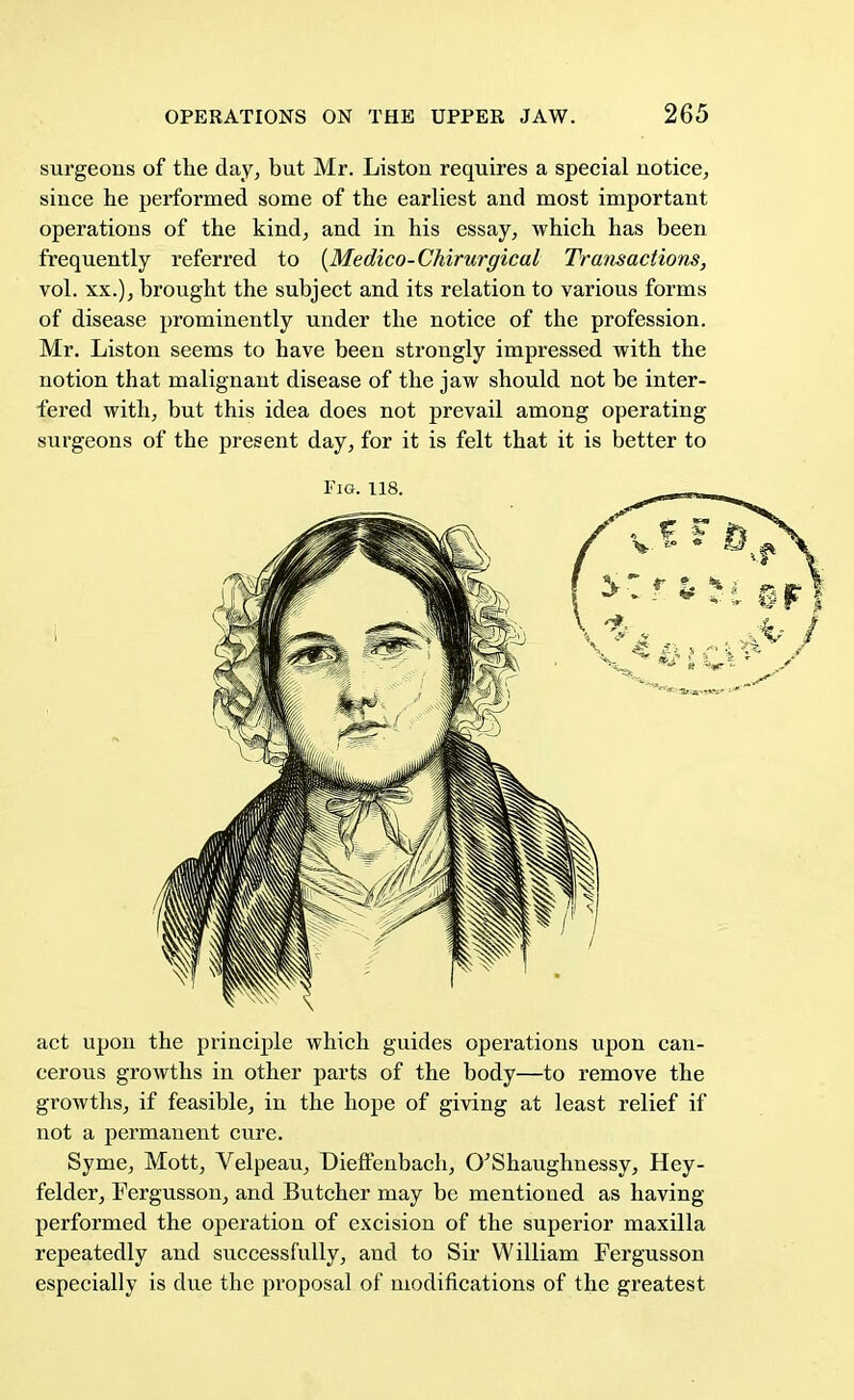 surgeons of the day, but Mr. Liston requires a special notice, since he performed some of the earliest and most important operations of the kind, and in his essay, which has been frequently referred to (Medico-CMrurgical Transactions, vol. xx.), brought the subject and its relation to various forms of disease prominently under the notice of the profession. Mr. Liston seems to have been strongly impressed with the notion that malignant disease of the jaw should not be inter- fered with, but this idea does not prevail among operating surgeons of the present day, for it is felt that it is better to act upon the principle which guides operations upon can- cerous growths in other parts of the body—to remove the growths, if feasible, in the hope of giving at least relief if not a permanent cure. Syme, Mott, Velpeau, Dieffenbach, O'Shaughnessy, Hey- felder, Fergusson, and Butcher may be mentioned as having performed the operation of excision of the superior maxilla repeatedly and successfully, and to Sir William Fergusson especially is due the proposal of modifications of the greatest