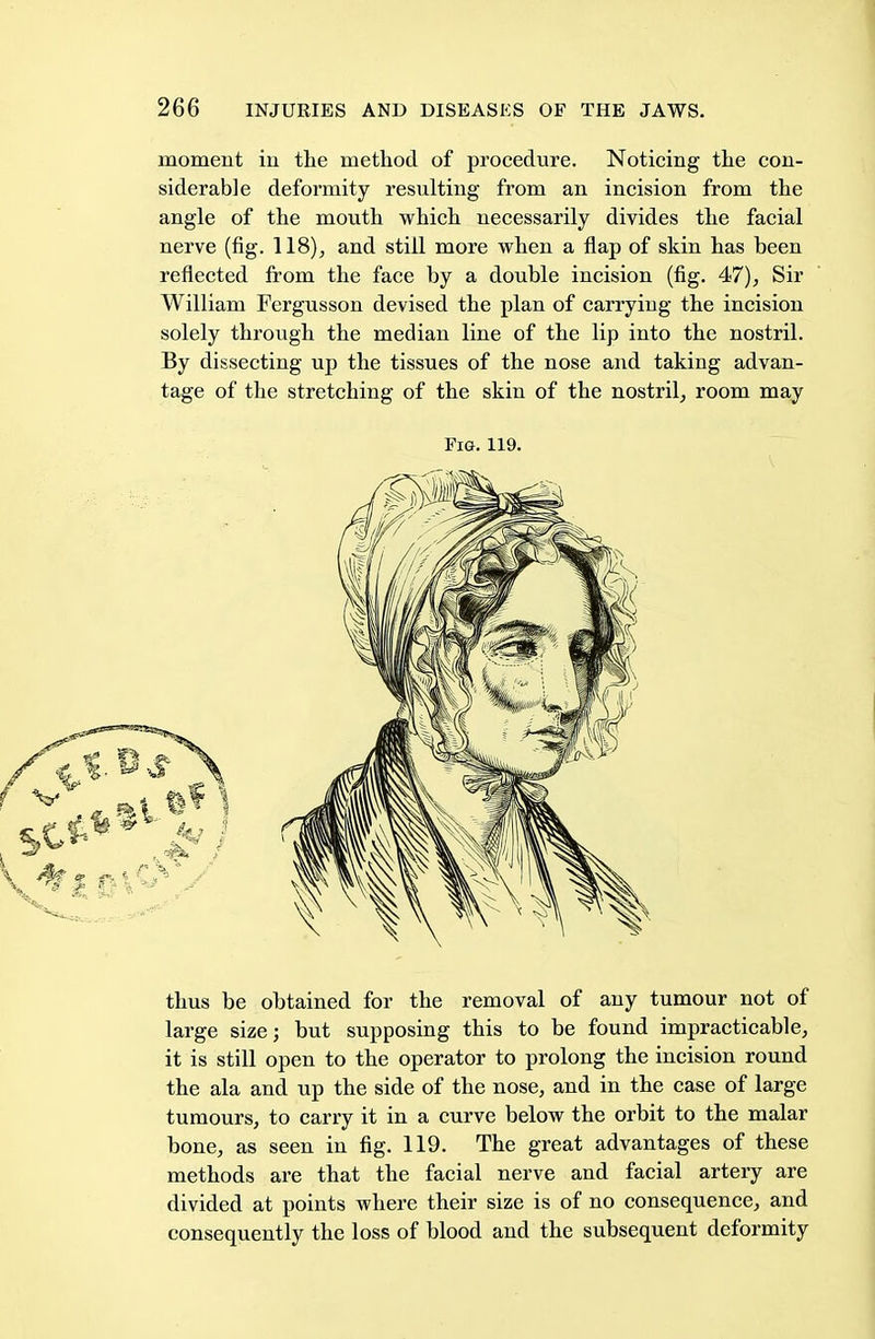 moment in the method of procedure. Noticing the con- siderable deformity resulting from an incision from the angle of the mouth which necessarily divides the facial nerve (fig. 118), and still more when a flap of skin has been reflected from the face by a double incision (fig. 47), Sir William Fergusson devised the plan of carrying the incision solely through the median line of the lip into the nostril. By dissecting up the tissues of the nose and taking advan- tage of the stretching of the skin of the nostril, room may Fig. 119. thus be obtained for the removal of any tumour not of large size; but supposing this to be found impracticable, it is still open to the operator to prolong the incision round the ala and up the side of the nose, and in the case of large tumours, to carry it in a curve below the orbit to the malar bone, as seen in fig. 119. The great advantages of these methods are that the facial nerve and facial artery are divided at points where their size is of no consequence, and consequently the loss of blood and the subsequent deformity