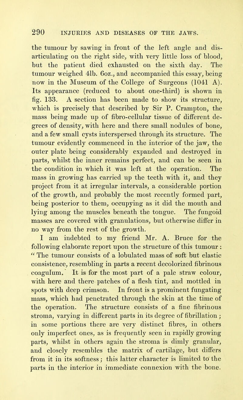the tumour by sawing in front of the left angle and dis- articulating on the right side, with very little loss of blood, but the patient died exhausted on the sixth day. The tumour weighed 41b. 6oz., and accompanied this essay, being now in the Museum of the College of Surgeons (1041 A). Its appearance (reduced to about one-third) is shown in fig. 133. A section has been made to show its structure, which is precisely that described by Sir P. Crampton, the mass being made up of fibro-cellular tissue of different de- grees of density, with here and there small nodules of bone, and a few small cysts interspersed through its structure. The tumour evidently commenced in the interior of the jaw, the outer plate being considerably expanded and destroyed in parts, whilst the inner remains perfect, and can be seen in the condition in which it was left at the operation. The mass in growing has carried up the teeth with it, and they project from it at irregular intervals, a considerable portion of the growth, and probably the most recently formed part, being posterior to them, occupying as it did the mouth and lying among the muscles beneath the tongue. The fungoid masses are covered with granulations, but otherwise differ in no way from the rest of the growth. I am indebted to my friend Mr. A. Bruce for the following elaborate report upon the structure of this tumour :  The tumour consists of a lobulated mass of soft but elastic consistence, resembling in parts a recent decolorized fibrinous coagulum. It is for the most part of a pale straw colour, with here and there patches of a flesh tint, and mottled in spots with deep crimson. In front is a prominent fungating mass, which had penetrated through the skin at the time of the operation. The structure consists of a fine fibrinous stroma, varying in different parts in its degree of fibrillation; in some portions there are very distinct fibres, in others only imperfect ones, as is frequently seen in rapidly growing parts, whilst in others again the stroma is dimly granular, and closely resembles the matrix of cartilage, but differs from it in its softness; this latter character is limited to the parts in the interior in immediate connexion with the bone.