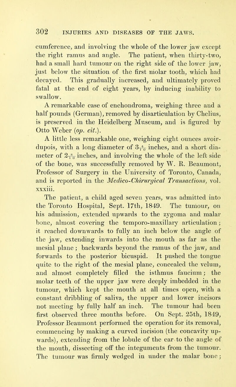 cumference, and involving the whole of the lower jaw except the right ramus and angle. The patient, when thirty-two, had a small hard tumour on the right side of the lower jaw, just below the situation of the first molar tooth, which had decayed. This gradually increased, and ultimately proved fatal at the end of eight years, by inducing inability to swallow. A remarkable case of enchondroma, weighing three and a half pounds (German), removed by disarticulation by Chelius, is preserved in the Heidelberg Museum, and is figured by Otto Weber {op. cit.). A little less remarkable one, weighing eight ounces avoir- dupois, with a long diameter of 3-^ inches, and a short dia- meter of 2t8-q inches, and involving the whole of the left side of the bone, was successfully removed by W. R. Beaumont, Professor of Surgery in the University of Toronto, Canada, and is reported in the Medico-Chirurgical Transactions, vol. xxxiii. The patient, a child aged seven years, was admitted into the Toronto Hospital, Sept. 17th, 1849. The tumour, on his admission, extended upwards to the zygoma and malar bone, almost covering the temporo-maxillary articulation; it reached downwards to fully an inch below the angle of the jaw, extending inwards into the mouth as far as the mesial plane; backwards beyond the ramus of the jaw, and forwards to the posterior bicuspid. It pushed the tongue quite to the right of the mesial plane, concealed the velum, and almost completely filled the isthmus faucium; the molar teeth of the upper jaw were deeply imbedded in the tumour, which kept the mouth at all times open, with a constant dribbling of saliva, the upper and lower incisors not meeting by fully half an inch. The tumour had been first observed three months before. On Sept. 25th, 1849, Professor Beaumont performed the operation for its removal, commencing by making a curved incision (the concavity up- wards), extending from the lobule of the ear to the angle of the mouth, dissecting off the integuments from the tumour. The tumour was firmly wedged in under the malar bone;