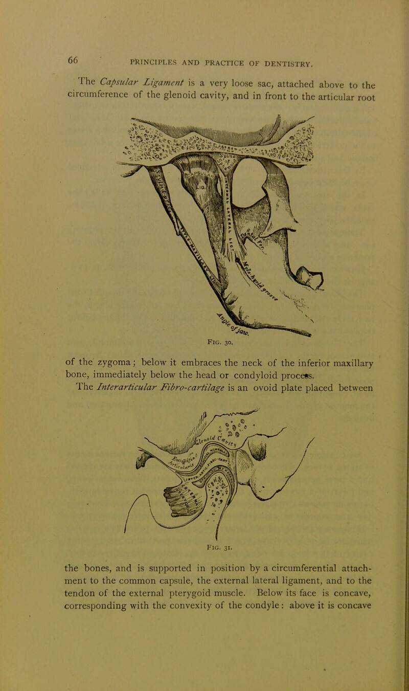 The Capsular Ligament is a very loose sac, attached above to the circumference of the glenoid cavity, and in front to the articular root Fig. 30. of the zygoma; below it embraces the neck of the inferior maxillary bone, immediately below the head or condyloid process. The Interarticular Fibro-cartilage is an ovoid plate placed between Fig. 31. the bones, and is supported in position by a circumferential attach- ment to the common capsule, the external lateral ligament, and to the tendon of the external pterygoid muscle. Below its face is concave, corresponding with the convexity of the condyle: above it is concave