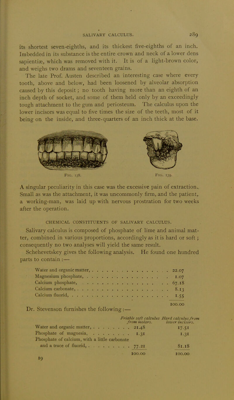 its shortest seven-eighths, and its thickest five-eighths of an inch. Imbedded in its substance is the entire crown and neck of a lower dens sapientiae, which was removed with it. It is of a light-brown color, and weighs two drams and seventeen grains. The late Prof. Austen described an interesting case where every tooth, above and below, had been loosened by alveolar absorption caused by this deposit; no tooth having more than an eighth of an inch depth of socket, and some of them held only by an exceedingly tough attachment to the gum and periosteum. The calculus upon the lower incisors was equal to five times the size of the teeth, most of it being on the inside, and three-quarters of an inch thick at the base. A singular peculiarity in this case was the excessive pain of extraction.. Small as was the attachment, it was uncommonly firm, and the patient, a working-man, was laid up with nervous prostration for two weeks after the operation. Salivary calculus is composed of phosphate of lime and animal mat- ter, combined in various proportions, accordingly as it is hard or soft ; consequently no two analyses will yield the same result. Schehevetskey gives the following analysis. He found one hundred parts to contain : — Water and organic matter, 22.07 Magnesium phosphate, 1.07 Calcium phosphate, 67.18 Calcium carbonate, 8.13 Calcium fluorid, 1.55 Fig. 138. Fig. 139. CHEMICAL CONSTITUENTS OF SALIVARY CALCULUS. IOO.OO Dr. Stevenson furnishes the following: Friable soft calculus Hard calculus from from molars. lower incisors. Water and organic matter, ......... Phosphate of magnesia, Phosphate of calcium, with a little carbonate 21.48 17.51 I-31 I.3I and a trace of fluorid 77.21 81.18 100.00 100.00