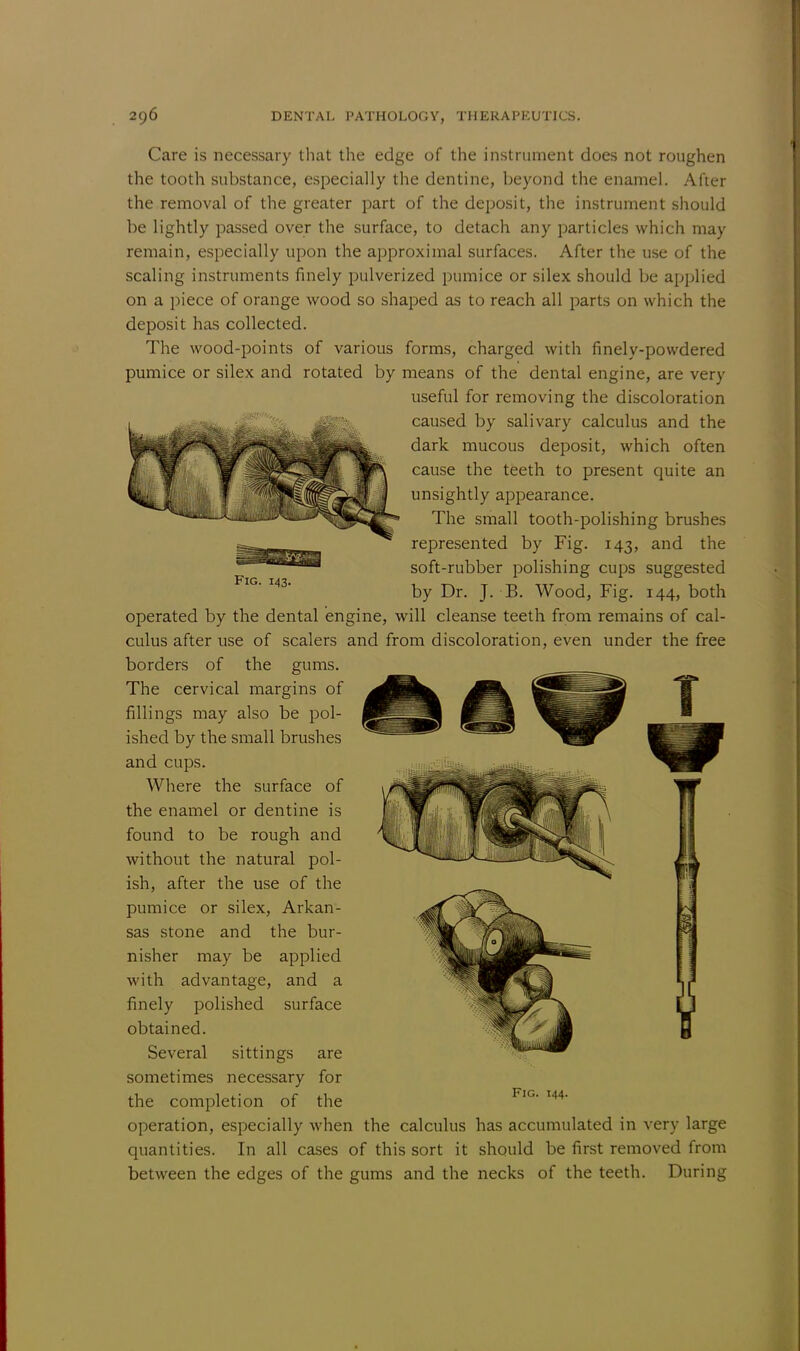 Fig. 143. Care is necessary that the edge of the instrument does not roughen the tooth substance, especially the dentine, beyond the enamel. After the removal of the greater part of the deposit, the instrument should be lightly passed over the surface, to detach any particles which may remain, especially upon the approximal surfaces. After the use of the scaling instruments finely pulverized pumice or silex should be applied on a piece of orange wood so shaped as to reach all parts on which the deposit has collected. The wood-points of various forms, charged with finely-powdered pumice or silex and rotated by means of the dental engine, are very useful for removing the discoloration caused by salivary calculus and the dark mucous deposit, which often cause the teeth to present quite an unsightly appearance. The small tooth-polishing brushes represented by Fig. 143, and the soft-rubber polishing cups suggested by Dr. J. B. Wood, Fig. 144, both operated by the dental engine, will cleanse teeth from remains of cal- culus after use of scalers and from discoloration, even under the free borders of the gums. The cervical margins of fillings may also be pol- ished by the small brushes and cups. Where the surface of the enamel or dentine is found to be rough and without the natural pol- ish, after the use of the pumice or silex, Arkan- sas stone and the bur- nisher may be applied with advantage, and a finely polished surface obtained. Several sittings are sometimes necessary for the completion of the operation, especially when the calculus has accumulated in very large quantities. In all cases of this sort it should be first removed from between the edges of the gums and the necks of the teeth. During