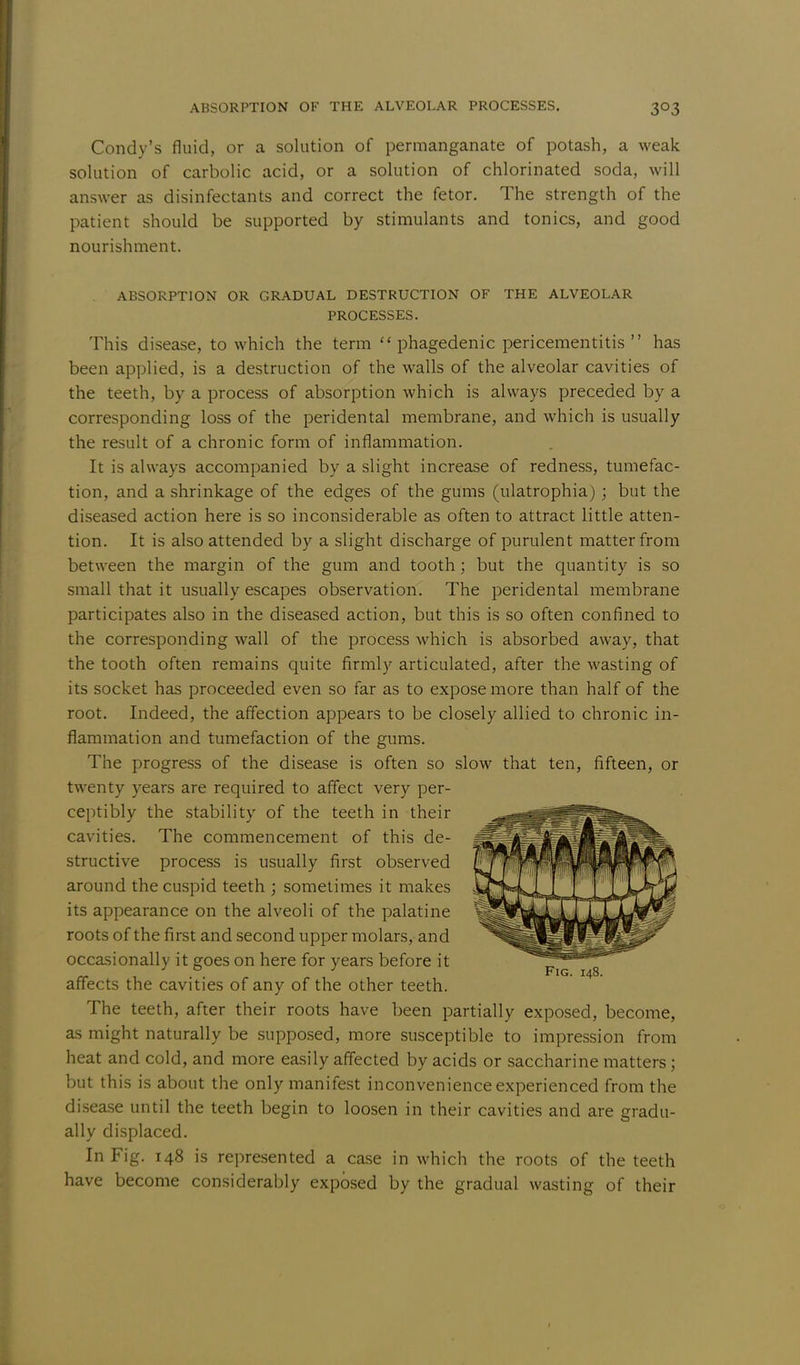 Condy's fluid, or a solution of permanganate of potash, a weak solution of carbolic acid, or a solution of chlorinated soda, will answer as disinfectants and correct the fetor. The strength of the patient should be supported by stimulants and tonics, and good nourishment. ABSORPTION OR GRADUAL DESTRUCTION OF THE ALVEOLAR PROCESSES. This disease, to which the term phagedenic pericementitis has been applied, is a destruction of the walls of the alveolar cavities of the teeth, by a process of absorption which is always preceded by a corresponding loss of the peridental membrane, and which is usually the result of a chronic form of inflammation. It is always accompanied by a slight increase of redness, tumefac- tion, and a shrinkage of the edges of the gums (ulatrophia) ; but the diseased action here is so inconsiderable as often to attract little atten- tion. It is also attended by a slight discharge of purulent matter from between the margin of the gum and tooth; but the quantity is so small that it usually escapes observation. The peridental membrane participates also in the diseased action, but this is so often confined to the corresponding wall of the process which is absorbed away, that the tooth often remains quite firmly articulated, after the wasting of its socket has proceeded even so far as to expose more than half of the root. Indeed, the affection appears to be closely allied to chronic in- flammation and tumefaction of the gums. The progress of the disease is often so slow that ten, fifteen, or twenty years are required to affect very per- ceptibly the stability of the teeth in their cavities. The commencement of this de- structive process is usually first observed around the cuspid teeth ; sometimes it makes its appearance on the alveoli of the palatine roots of the first and second upper molars, and occasionally it goes on here for years before it affects the cavities of any of the other teeth. The teeth, after their roots have been partially exposed, become, as might naturally be supposed, more susceptible to impression from heat and cold, and more easily affected by acids or saccharine matters; but this is about the only manifest inconvenience experienced from the disease until the teeth begin to loosen in their cavities and are gradu- ally displaced. In Fig. 148 is represented a case in which the roots of the teeth have become considerably exposed by the gradual wasting of their Fig. 148.