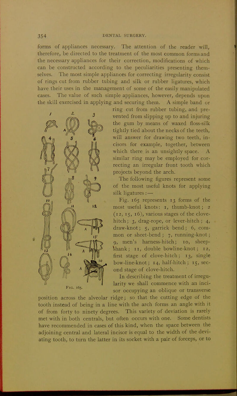 forms of appliances necessary. The attention of the reader will, therefore, be directed to the treatment of the most common forms and the necessary appliances for their correction, modifications of which can be constructed according to the peculiarities presenting them- selves. The most simple appliances for correcting irregularity consist of rings cut from rubber tubing and silk or rubber ligatures, which have their uses in the management of some of the easily manipulated cases. The value of such simple appliances, however, depends upon the skill exercised in applying and securing them. A simple band or ring cut from rubber tubing, and pre- vented from slipping up to and injuring the gum by means of waxed floss-silk tightly tied about the necks of the teeth, will answer for drawing two teeth, in- cisors for example, together, between which there is an unsightly space. A similar ring may be employed for cor- recting an irregular front tooth which projects beyond the arch. The following figures represent some of the most useful knots for applying silk ligatures : — Fig. 165 represents 13 forms of the most useful knots: r, thumb-knot; 2 (12, 15, 16), various stages of the clove- hitch; 3, drag-rope, or lever-hitch; 4, draw-knot; 5, garrick bend: 6, com- mon or sheet-bend ; 7, running-knot; 9, men's harness-hitch; 10, sheep- shank; 11, double bowline-knot; 12, first stage of clove-hitch; 13, single bow-line-knot; 14, half-hitch ; 15, sec- ond stage of clove-hitch. In describing the treatment of irregu- larity we shall commence with an inci- sor occupying an oblique or transverse position across the alveolar ridge; so that the cutting edge of the tooth instead of being in a line with the arch forms an angle with it of from forty to ninety degrees. This variety of deviation is rarely met with in both centrals, but often occurs with one. Some dentists have recommended in cases of this kind, when the space between the adjoining central and lateral incisor is equal to the width of the devi- ating tooth, to turn the latter in its socket with a pair of forceps, or to
