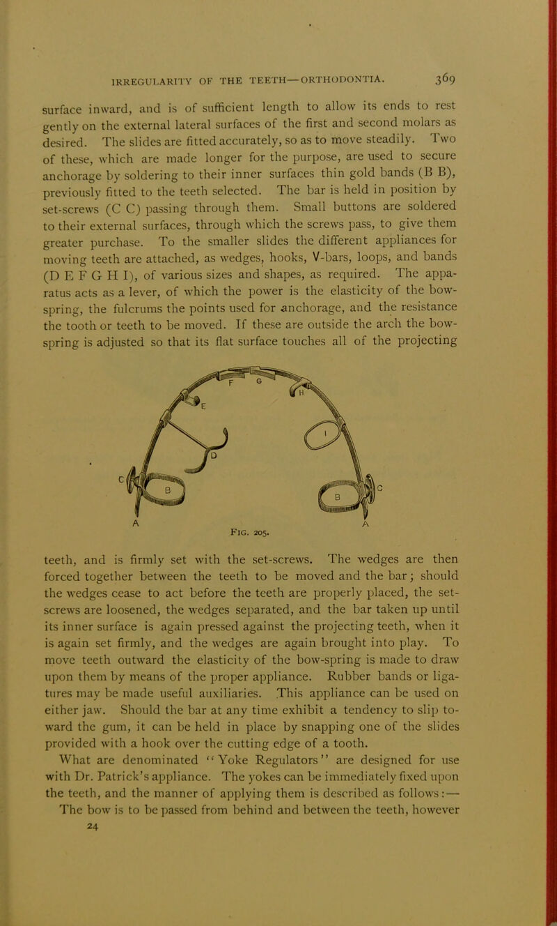 surface inward, and is of sufficient length to allow its ends to rest gently on the external lateral surfaces of the first and second molars as desired. The slides are fitted accurately, so as to move steadily. Two of these, which are made longer for the purpose, are used to secure anchorage by soldering to their inner surfaces thin gold bands (B B), previously fitted to the teeth selected. The bar is held in position by set-screws (C C) passing through them. Small buttons are soldered to their external surfaces, through which the screws pass, to give them greater purchase. To the smaller slides the different appliances for moving teeth are attached, as wedges, hooks, V-bars, loops, and bands (D E F G H I), of various sizes and shapes, as required. The appa- ratus acts as a lever, of which the power is the elasticity of the bow- spring, the fulcrums the points used for anchorage, and the resistance the tooth or teeth to be moved. If these are outside the arch the bow- spring is adjusted so that its flat surface touches all of the projecting Fig. 205. teeth, and is firmly set with the set-screws. The wedges are then forced together between the teeth to be moved and the bar; should the wedges cease to act before the teeth are properly placed, the set- screws are loosened, the wedges separated, and the bar taken up until its inner surface is again pressed against the projecting teeth, when it is again set firmly, and the wedges are again brought into play. To move teeth outward the elasticity of the bow-spring is made to draw upon them by means of the proper appliance. Rubber bands or liga- tures may be made useful auxiliaries. This appliance can be used on either jaw. Should the bar at any time exhibit a tendency to slip to- ward the gum, it can be held in place by snapping one of the slides provided with a hook over the cutting edge of a tooth. What are denominated Yoke Regulators are designed for use with Dr. Patrick's appliance. The yokes can be immediately fixed upon the teeth, and the manner of applying them is described as follows: — The bow is to be passed from behind and between the teeth, however 24