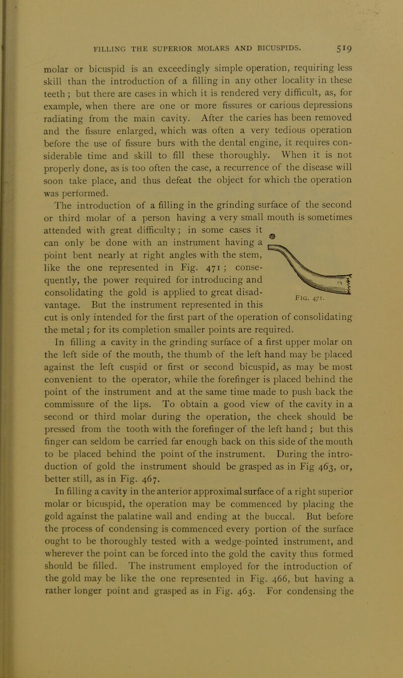 molar or bicuspid is an exceedingly simple operation, requiring less skill than the introduction of a filling in any other locality in these teeth; but there are cases in which it is rendered very difficult, as, for example, when there are one or more fissures or carious depressions radiating from the main cavity. After the caries has been removed and the fissure enlarged, which was often a very tedious operation before the use of fissure burs with the dental engine, it requires con- siderable time and skill to fill these thoroughly. When it is not properly done, as is too often the case, a recurrence of the disease will soon take place, and thus defeat the object for which the operation was performed. The introduction of a filling in the grinding surface of the second or third molar of a person having a very small mouth is sometimes attended with great difficulty; in some cases it can only be done with an instrument having a point bent nearly at right angles with the stem, like the one represented in Fig. 471 ; conse- quently, the power required for introducing and consolidating the gold is applied to great disad- vantage. But the instrument represented in this cut is only intended for the first part of the operation of consolidating the metal; for its completion smaller points are required. In filling a cavity in the grinding surface of a first upper molar on the left side of the mouth, the thumb of the left hand may be placed against the left cuspid or first or second bicuspid, as may be most convenient to the operator, while the forefinger is placed behind the point of the instrument and at the same time made to push back the commissure of the lips. To obtain a good view of the cavity in a second or third molar during the operation, the cheek should be pressed from the tooth with the forefinger of the left hand ; but this finger can seldom be carried far enough back on this side of the mouth to be placed behind the point of the instrument. During the intro- duction of gold the instrument should be grasped as in Fig 463, or, better still, as in Fig. 467. In filling a cavity in the anterior approximal surface of a right superior molar or bicuspid, the operation may be commenced by placing the gold against the palatine wall and ending at the buccal. But before the process of condensing is commenced every portion of the surface ought to be thoroughly tested with a wedge-pointed instrument, and wherever the point can be forced into the gold the cavity thus formed should be filled. The instrument employed for the introduction of the gold may be like the one represented in Fig. 466, but having a rather longer point and grasped as in Fig. 463. For condensing the