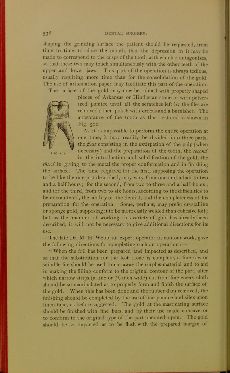 shaping the grinding surface the patient should be requested, from time to time, to close the mouth, that the depression in it may be made to correspond to the cusps of the tooth with which it antagonizes, so that these two may touch simultaneously with the other teeth of the upper and lower jaws. This part of the operation is always tedious, usually requiring more time than for the consolidation of the gold. The use of articulation paper may facilitate this part of the operation. The surface of the gold may now be rubbed with properly shaped pieces of Arkansas or Hindostan stone or with pulver- ized pumice until all the scratches left by the files are removed; then polish with crocus and a burnisher. The appearance of the tooth as thus restored is shown in Fig. 502. As it is impossible to perform the entire operation at one time, it may readily be divided into three parts, the first consisting in the extirpation of the pulp (when necessary) and the preparation of the tooth, the second in the introduction and solidification of the gold, the third in giving to the metal the proper conformation and in finishing the surface. The time required for the first, supposing the operation to be like the one just described, may vary from one and a half to two and a half hours ; for the second, from two to three and a half hours ; and for the third, from two to six hours, according to the difficulties to be encountered, the ability of the dentist, and the completeness of his preparation for the operation. Some, perhaps, may prefer crystalline or sponge gold, supposing it to be more easily welded than cohesive foil; but as the manner of working this variety of gold has already been described, it will not be necessary to give additional directions for its use. The late Dr. M. H. Webb, an expert operator in contour work, gave the following directions for completing such an operation : — When the foil has been prepared and impacted as described, and so that the substitution for the lost tissue is complete, a fine saw or suitable file should be used to cut away the surplus material and to aid in making the filling conform to the original contour of the part, after which narrow strips (a line or ^-inch wide) cut from fine emery cloth should be so manipulated as to properly form and finish the surface of the gold. When this has been done and the rubber dam removed, the finishing should be completed by the use of fine pumice and silex upon linen tape, as before suggested. The gold at the masticating surface should be finished with fine burs, and by their use made concave or to conform to the original type of the part operated upon. The gold should be so impacted as to be flush with the prepared margin of