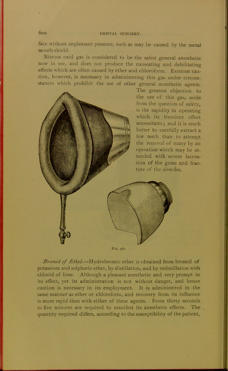 face without unpleasant pressure, such as may be caused by the metal mouth-shield. Nitrous oxid gas is considered to be the safest general anesthetic now in use, and does not produce the nauseating and debilitating effects which are often caused by ether and chloroform. Extreme cau- tion, however, is necessary in administering this gas under circum- stances which prohibit the use of other general anesthetic agents. The greatest objection to the use of this gas, aside from the question of safety, is the rapidity in operating which its transient effect necessitates; and it is much better to carefully extract a few teeth than to attempt the removal of many by an operation which may be at- tended with severe lacera- tion of the gums and frac- ture of the alveolus. Fig. 581. Bromid of Ethyl.—Hydrobromic ether is obtained from bromid of potassium and sulphuric ether, by distillation, and by redistillation with chlorid of lime. Although a pleasant anesthetic and very prompt in its effect, yet its administration is not without danger, and hence caution is necessary in its employment. It is administered in the same manner as ether or chloroform, and recovery from its influence is more rapid than with either of these agents. From thirty seconds to five minutes are required to manifest its anesthetic effects. The quantity required differs, according to the susceptibility of the patient,