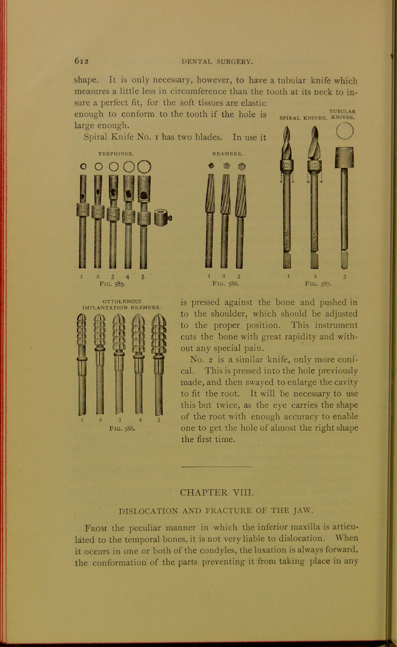 shape. It is only necessary, however, to have a tubular knife which measures a little less in circumference than the tooth at its neck to in- sure a perfect fit, for the soft tissues are elastic enough to conform to the tooth if the hole is spiral knives. TknTv^r large enough. Spiral Knife No. i has two blades. In use it TREPHINliS. o o OOO I OTTOLENGUI IMPLANTATION REAMERS. Fig. 587. is pressed against the bone and pushed in to the shoulder, which should be adjusted to the proper position. This instrument cuts the bone with great rapidity and with- out any special pain. No. 2 is a similar knife, only more coni- cal. This is pressed into the hole previously made, and then swayed to enlarge the cavity to fit the root. It will be necessary to use this but twice, as the eye carries the shape of the root with enough accuracy to enable one to get the hole of almost the right shape the first time. CHAPTER VIII. DISLOCATION AND FRACTURE OF THE JAW. From the peculiar manner in which the inferior maxilla is articu- lated to the temporal bones, it is not very liable to dislocation. When it occurs in one or both of the condyles, the luxation is always forward, the conformation of the parts preventing it from taking place in any