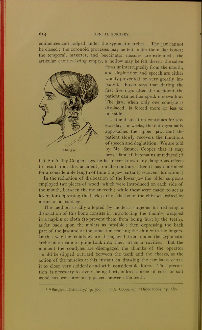 eminences and lodged under the zygomatic arches. The jaw cannot be closed; the coronoid processes may be felt under the malar bones; the temporal, masseter, and buccinator muscles are extended; the articular cavities being empty, a hollow may be felt there; the saliva flows uninterruptedly from the mouth, and deglutition and speech are either wholly prevented or very greatly im- paired. Boyer says that during the first five days after the accident the patient can neither speak nor swallow. The jaw, when only one condyle is displaced, is forced more or less to one side. If the dislocation continues for sev- eral days or weeks, the chin gradually approaches the upper jaw, and the patient slowly recovers the functions pf speech and deglutition. We are told fig. 589. by Mr. Samuel Cooper that it may prove fatal if it remains unreduced ; * but Sir Astley Cooper says he has never known any dangerous effects to result from this accident; on the contrary, after it has continued for a considerable length of time the jaw partially recovers its motion.^ In the reduction of dislocation of the lower jaw the older surgeons employed two pieces of wood, which were introduced on each side of the mouth, between the molar teeth ; while these were made to act as levers for depressing the back part of the bone, the chin was raised by means of a bandage. The method usually adopted by modern surgeons for reducing a dislocation of this bone consists in introducing the thumbs, wrapped in a napkin or cloth (to prevent them from being hurt by the teeth), as far back upon the molars as possible; then depressing the back part of the jaw and at the same time raising the chin with the fingers. In this way the condyles are disengaged from under the zygomatic arches and made to glide back into their articular cavities. But the moment the condyles are disengaged the thumbs of the operator should be slipped outward between the teeth and the cheeks, as the action of the muscles at this instant, in drawing the jaw back, causes it to close very suddenly and with considerable force. This precau- tion is necessary to avoid being hurt, unless a piece of cork or soft wood has been previously placed between the teeth. *  Surgical Dictionary, p. 306. f A. Cooper on  Dislocations, p. 389.