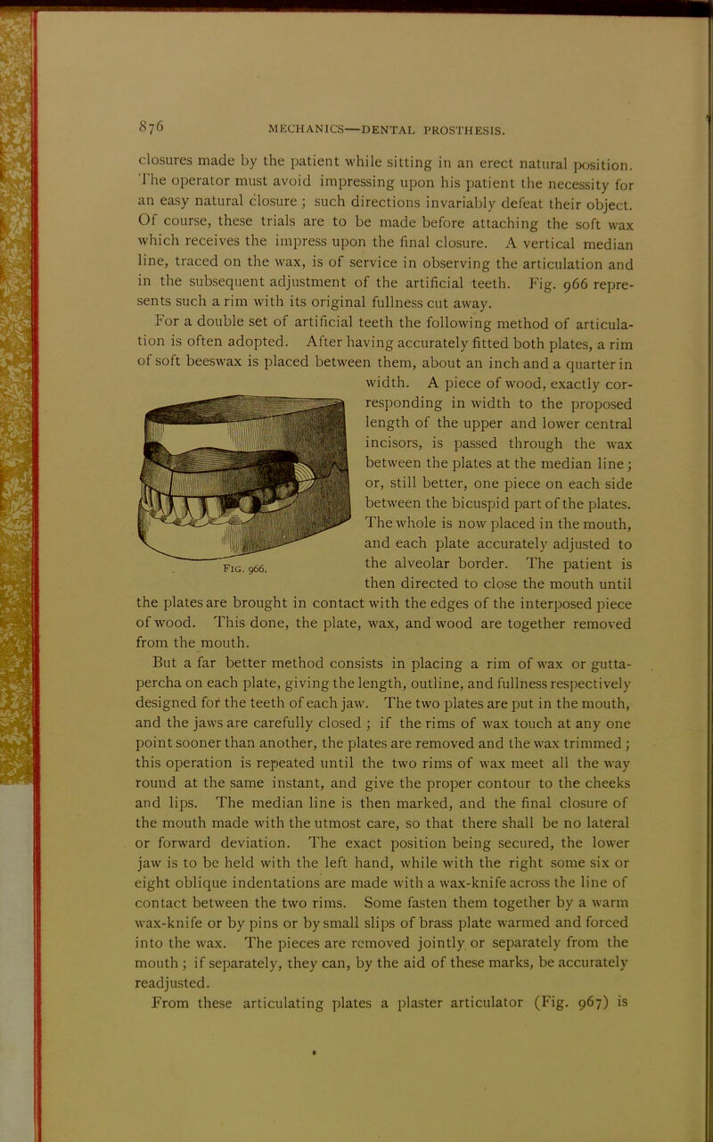 closures made by the patient while sitting in an erect natural position. The operator must avoid impressing upon his patient the necessity for an easy natural closure ; such directions invariably defeat their object. Of course, these trials are to be made before attaching the soft wax which receives the impress upon the final closure. A vertical median line, traced on the wax, is of service in observing the articulation and in the subsequent adjustment of the artificial teeth. Fig. 966 repre- sents such a rim with its original fullness cut away. For a double set of artificial teeth the following method of articula- tion is often adopted. After having accurately fitted both plates, a rim of soft beeswax is placed between them, about an inch and a quarter in width. A piece of wood, exactly cor- responding in width to the proposed length of the upper and lower central incisors, is passed through the wax between the plates at the median line; or, still better, one piece on each side between the bicuspid part of the plates. The whole is now placed in the mouth, and each plate accurately adjusted to the alveolar border. The patient is then directed to close the mouth until the plates are brought in contact with the edges of the interposed piece of wood. This done, the plate, wax, and wood are together removed from the mouth. But a far better method consists in placing a rim of wax or gutta- percha on each plate, giving the length, outline, and fullness respectively designed for the teeth of each jaw. The two plates are put in the mouth, and the jaws are carefully closed ; if the rims of wax touch at any one point sooner than another, the plates are removed and the wax trimmed ; this operation is repeated until the two rims of wax meet all the way round at the same instant, and give the proper contour to the cheeks and lips. The median line is then marked, and the final closure of the mouth made with the utmost care, so that there shall be no lateral or forward deviation. The exact position being secured, the lower jaw is to be held with the left hand, while with the right some six or eight oblique indentations are made with a wax-knife across the line of contact between the two rims. Some fasten them together by a warm wax-knife or by pins or by small slips of brass plate warmed and forced into the wax. The pieces are removed jointly or separately from the mouth ; if separately, they can, by the aid of these marks, be accurately readjusted. From these articulating plates a plaster articulator (Fig. 967) is