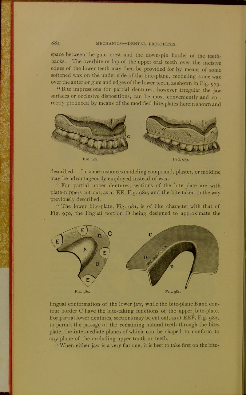 space between the gum crest and the down-pin border of the teeth- backs. The overbite or lap of the upper oral teeth over the incisive edges of the lower teeth may then be provided for by means of some softened wax on the under side of the bite-plane, modeling some wax over the anterior gum and edges of the lower teeth, as shown in Fig. 979.  Bite impressions for partial dentures, however irregular the jaw surfaces or occlusive dispositions, can be most conveniently and cor- rectly produced by means of the modified bite-plates herein shown and Fig. 978. Fig. 979. described. In some instances modeling compound, plaster, or moldine may be advantageously employed instead of wax. For partial upper dentures, sections of the bite-plate are with plate-nippers cut out, as at EE, Fig. 980, and the bite taken in the way previously described.  The lower bite-plate, Fig. 981, is of like character with that of Fig. 970, the lingual portion D being designed to approximate the lingual conformation of the lower jaw, while the bite-plane B and con- tour border C have the bite-taking functions of the upperbite-plate. For partial lower dentures, sections may be cut out, as at EEF, Fig. 9S2, to permit the passage of the remaining natural teeth through the bite- plate, the intermediate planes of which can be shaped to conform to any plane of the occluding upper tooth or teeth.  When either jaw is a very flat one, it is best to take first on the bite-