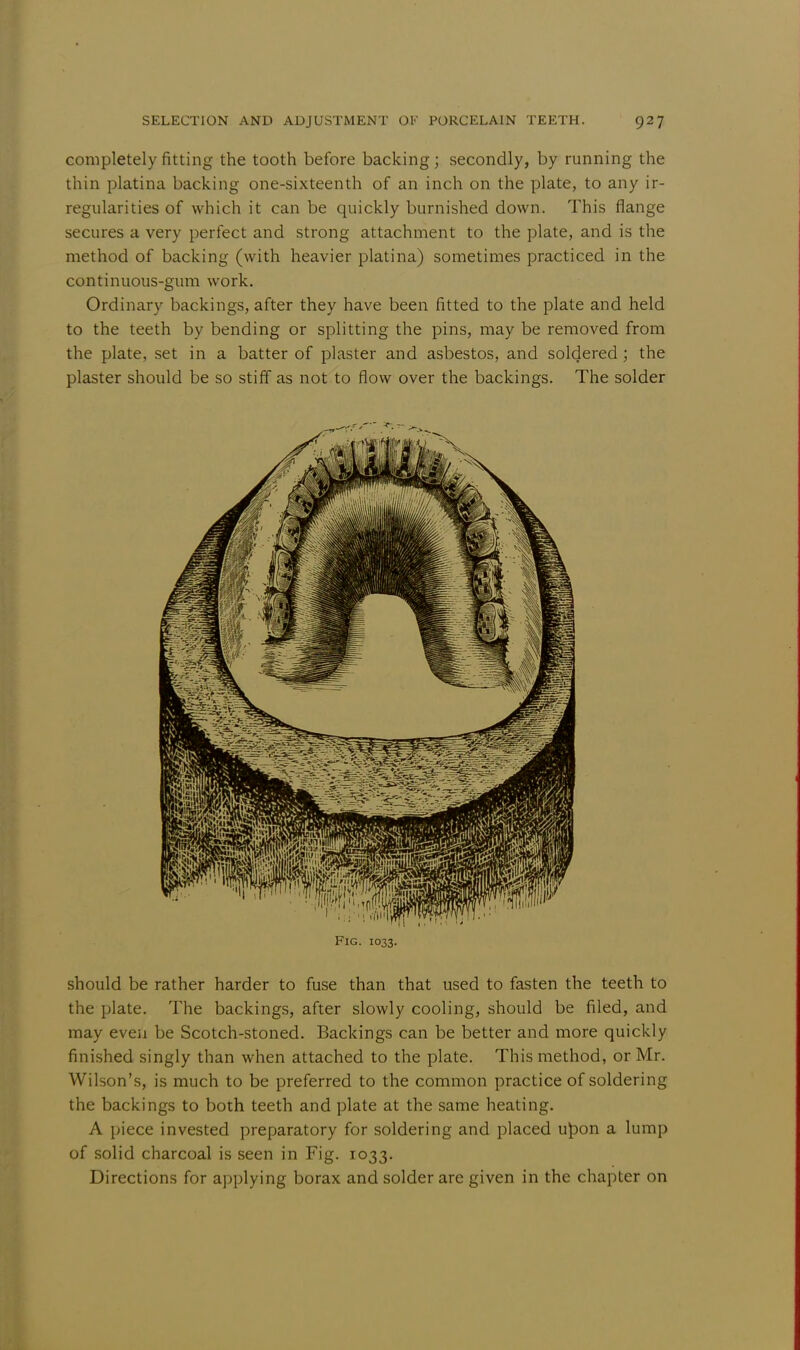 completely fitting the tooth before backing; secondly, by running the thin platina backing one-sixteenth of an inch on the plate, to any ir- regularities of which it can be quickly burnished down. This flange secures a very perfect and strong attachment to the plate, and is the method of backing (with heavier platina) sometimes practiced in the continuous-gum work. Ordinary backings, after they have been fitted to the plate and held to the teeth by bending or splitting the pins, may be removed from the plate, set in a batter of plaster and asbestos, and soldered; the plaster should be so stiff as not to flow over the backings. The solder Fig. 1033. should be rather harder to fuse than that used to fasten the teeth to the plate. The backings, after slowly cooling, should be filed, and may even be Scotch-stoned. Backings can be better and more quickly finished singly than when attached to the plate. This method, or Mr. Wilson's, is much to be preferred to the common practice of soldering the backings to both teeth and plate at the same heating. A piece invested preparatory for soldering and placed upon a lump of solid charcoal is seen in Fig. 1033. Directions for applying borax and solder are given in the chapter on