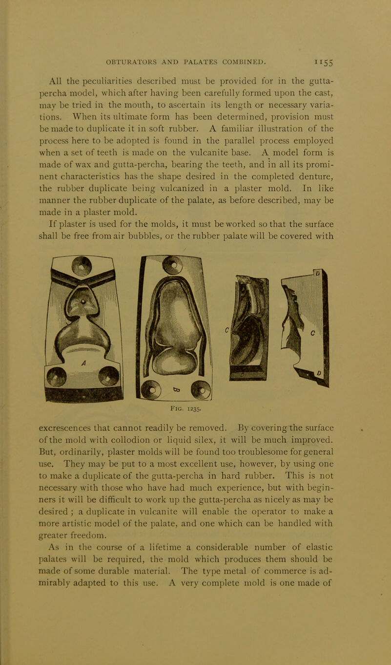 All the peculiarities described must be provided for in the gutta- percha model, which after having been carefully formed upon the cast, may be tried in the mouth, to ascertain its length or necessary varia- tions. When its ultimate form has been determined, provision must be made to duplicate it in soft rubber. A familiar illustration of the process here to be adopted is found in the parallel process employed when a set of teeth is made on the vulcanite base. A model form is made of wax and gutta-percha, bearing the teeth, and in all its promi- nent characteristics has the shape desired in the completed denture, the rubber duplicate being vulcanized in a plaster mold. In like manner the rubber duplicate of the palate, as before described, may be made in a plaster mold. If plaster is used for the molds, it must be worked so that the surface shall be free from air bubbles, or the rubber palate will be covered with Fig. 1235. excrescences that cannot readily be removed. By covering the surface of the mold with collodion or liquid silex, it will be much improved. But, ordinarily, plaster molds will be found too troublesome for general use. They may be put to a most excellent use, however, by using one to make a duplicate of the gutta-percha in hard rubber. This is not necessary with those who have had much experience, but with begin- ners it will be difficult to work up the gutta-percha as nicely as may be desired ; a duplicate in vulcanite will enable the operator to make a more artistic model of the palate, and one which can be handled with greater freedom. As in the course of a lifetime a considerable number of elastic palates will be required, the mold which produces them should be made of some durable material. The type metal of commerce is ad- mirably adapted to this use. A very complete mold is one made of