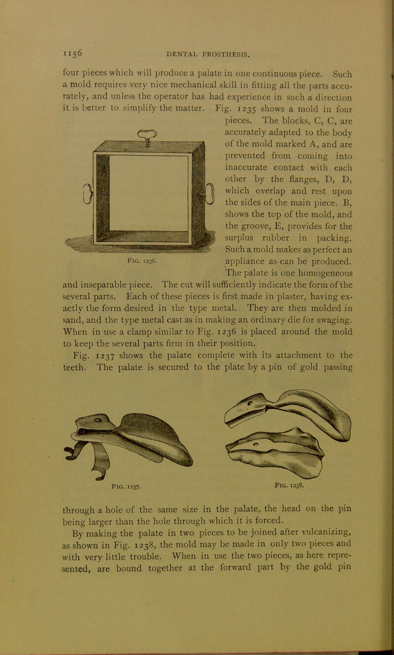 four pieces which will produce a palate in one continuous piece. Such a mold requires very nice mechanical skill in fitting all the parts accu- rately, and unless the operator has had experience in such a direction it is better to simplify the matter. Fig. 1235 shows a mold in four pieces. The blocks, C, C, are accurately adapted to the body of the mold marked A, and are prevented from coming into inaccurate contact with each other by the flanges, D, D, which overlap and rest upon the sides of the main piece. B, shows the top of the mold, and the groove, E, provides for the surplus rubber in packing. Such a mold makes as perfect an fig. 1236. appliance as can be produced. The palate is one homogeneous and inseparable piece. The cut will sufficiently indicate the form of the several parts. Each of these pieces is first made in plaster, having ex- actly the form desired in the type metal. They are then molded in sand, and the type metal cast as in making an ordinary die for swaging. When in use a clamp similar to Fig. 1236 is placed around the mold to keep the several parts firm in their position. Fig. 1237 shows the palate complete with its attachment to the teeth. The palate is secured to the plate by a pin of gold passing Fig. 1237. Fig. 123S. through a hole of the same size in the palate, the head on the pin being larger than the hole through which it is forced. By making the palate in two pieces to be joined after vulcanizing, as shown in Fig. 1238, the mold may be made in only two pieces and with very little trouble. When in use the two pieces, as here repre- sented, are bound together at the forward part by the gold pin