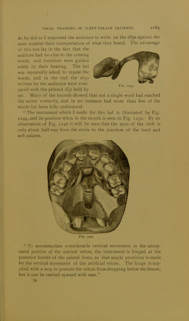 As he did so I requested the audience to write on the slips against the same number their interpretation of what they heard. The advantage of this test lay in the fact that the auditors had no clue to the coming words, and therefore were guided solely by their hearing. The lad was repeatedly asked to repeat the words, arid in the end the slips written by the audience were com- pared with the printed slip held by me. 'Many of the records showed that not a single word had reached the writer correctly, and in no instance had more than five of the whole list been fully understood. 1' The instrument which I made for this lad is illustrated by Fig. 1249, and its position when in the mouth is seen in Fig. 1250. By an observation of Fig. 1246 it will be seen that the apex of the cleft is only about half-way from the uvula to the junction of the hard and soft palates. Fig. 1250. tt To accommodate considerable vertical movement in the unrup- tured portion of the natural velum, the instrument is hinged at the posterior border of the palatal bone, so that ample provision is made for the vertical movement of the artificial velum. The hinge is sup- plied with a stop to prevent the velum from dropping below the fissure, but it can be carried upward with ease. 74
