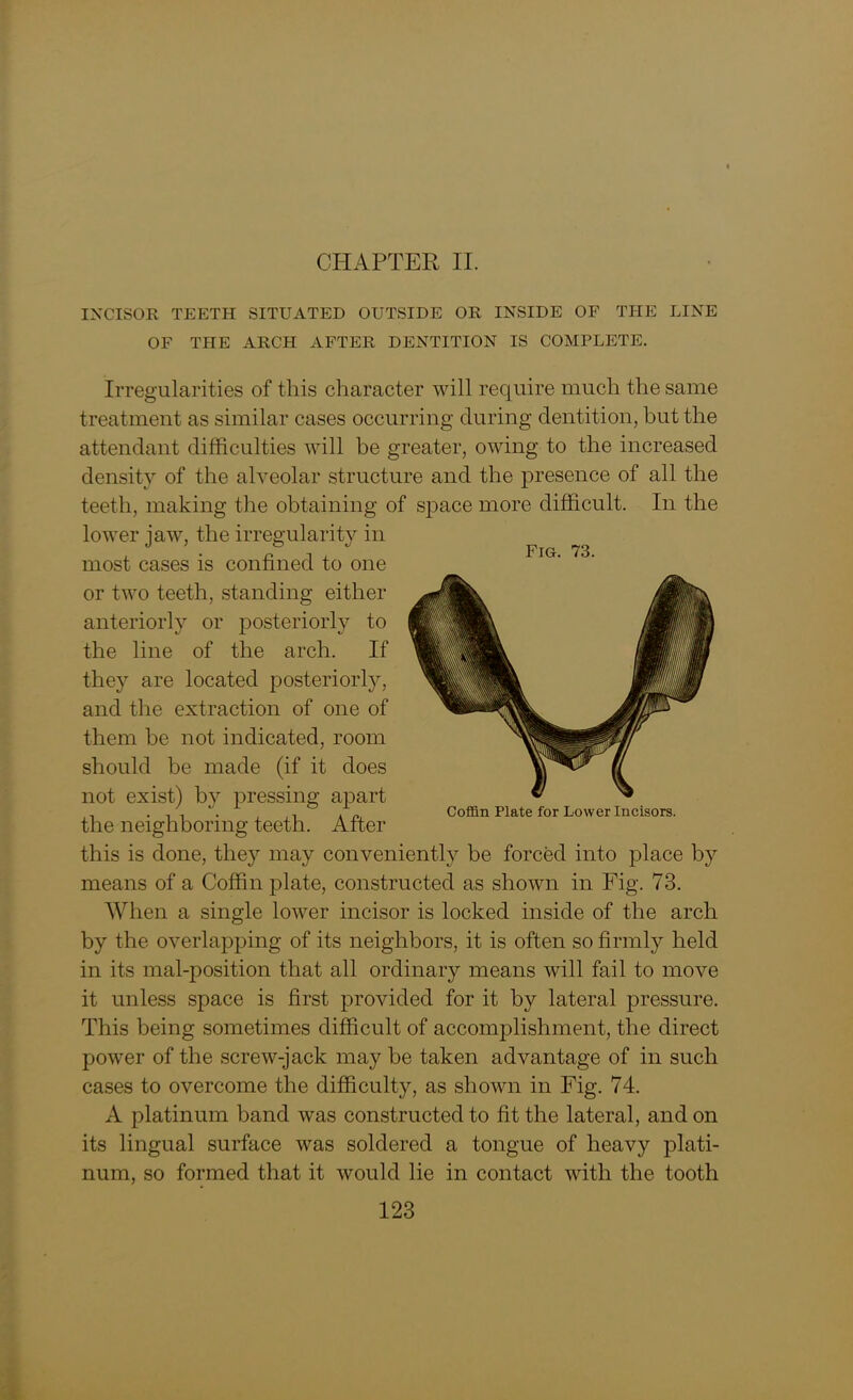 CHAPTER II. INCISOR TEETH SITUATED OUTSIDE OR INSIDE OF THE LINE OF THE ARCH AFTER DENTITION IS COMPLETE. Irregularities of this character will require much the same treatment as similar cases occurring during dentition, but the attendant difficulties will be greater, owing to the increased density of the alveolar structure and the presence of all the teeth, making the obtaining of space more difficult. In the lower jaw, the irregularity in most cases is confined to one or two teeth, standing either anteriorly or posteriorly to the line of the arch. If they are located posteriorly, and the extraction of one of them be not indicated, room should be made (if it does not exist) by pressing apart . , , . .. . „ Coffin Plate for Lower Incisors. the neighboring teeth. Alter this is done, they may conveniently be forced into place by means of a Coffin plate, constructed as shown in Fig. 73. When a single lower incisor is locked inside of the arch by the overlapping of its neighbors, it is often so firmly held in its mal-position that all ordinary means will fail to move it unless space is first provided for it by lateral pressure. This being sometimes difficult of accomplishment, the direct power of the screw-jack may be taken advantage of in such cases to overcome the difficulty, as shown in Fig. 74. A platinum band was constructed to fit the lateral, and on its lingual surface was soldered a tongue of heavy plati- num, so formed that it would lie in contact with the tooth
