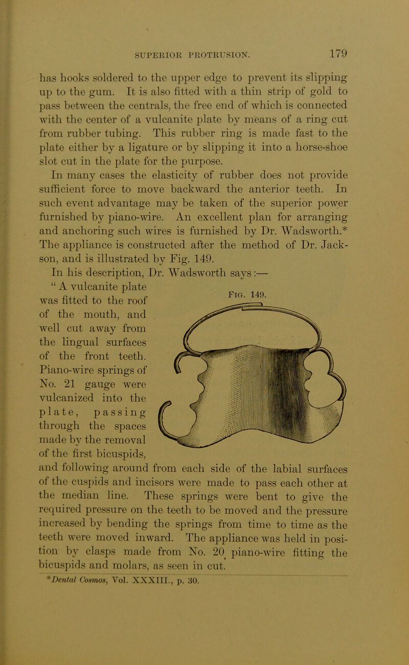 has hooks soldered to the upper edge to prevent its slipping up to the gum. It is also fitted with a thin strip of gold to pass between the centrals, the free end of which is connected with the center of a vulcanite plate by means of a ring cut from rubber tubing. This rubber ring is made fast to the plate either by a ligature or by slipping it into a horse-shoe slot cut in the plate for the purpose. In many cases the elasticity of rubber does not provide sufficient force to move backward the anterior teeth. In such event advantage may be taken of the superior power furnished by piano-wire. An excellent plan for arranging and anchoring such wires is furnished by Dr. Wadsworth.* The appliance is constructed after the method of Dr. Jack- son, and is illustrated by Fig. 149. In his description, Dr. Wadsworth says:— “ A vulcanite plate was fitted to the roof of the mouth, and well cut away from the lingual surfaces of the front teeth. Piano-wire springs of No. 21 gauge were vulcanized into the plate, passing through the spaces made by the removal of the first bicuspids, and following around from each side of the labial surfaces of the cuspids and incisors were made to pass each other at the median line. These springs were bent to give the required pressure on the teeth to be moved and the pressure increased by bending the springs from time to time as the teeth were moved inward. The appliance was held in posi- tion by clasps made from No. 2() piano-wire fitting the bicuspids and molars, as seen in cut. *Den(al Cosmos, Vol. XXXIII., p. 30.