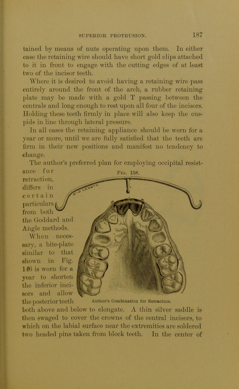 tained by means of nuts operating upon them. In either case the retaining wire should have short gold clips attached to it in front to engage with the cutting edges of at least two of the incisor teeth. Where it is desired to avoid having a retaining wire pass entirely around the front of the arch, a rubber retaining plate may be made with a gold T passing between the centrals and long enough to rest upon all four of the incisors. Holding these teeth firmly in place will also keep the cus- pids in line through lateral pressure. In all cases the retaining appliance should be worn for a year or more, until we are fully satisfied that the teeth are firm in their new positions and manifest no tendency to change. The author’s preferred plan for employing occipital resist- ance tor Fre. 158. retraction, differs in certain particulars from both the Goddard and methods. When neces- sary, a bite-plate similar to that shown in Fig. 146 is worn for a year to shorten the inferior inci- sors and allow the posterior teeth Author’s Combination for Retraction. both above and below to elongate. A thin silver saddle is then swaged to cover the crowns of the central incisors, to which on the labial surface near the extremities are soldered two headed pins taken from block teeth. In the center of