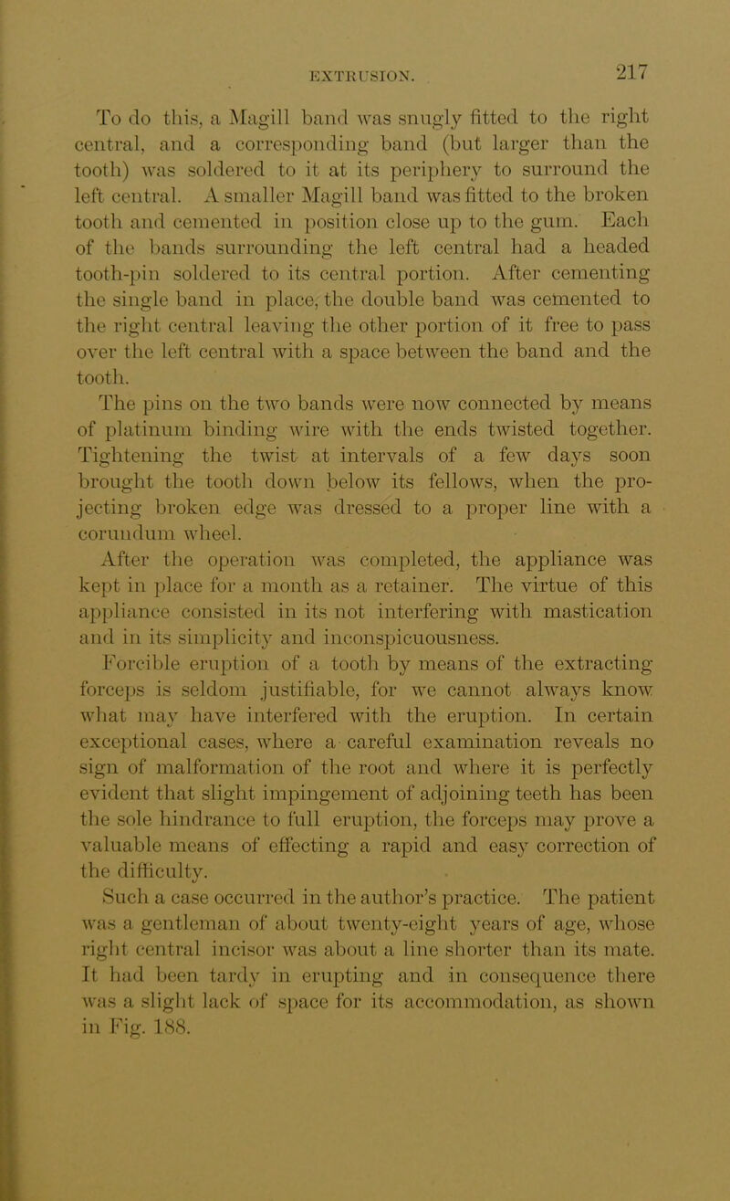 To do this, a Magill band was snugly fitted to the right central, and a corresponding band (but larger than the tooth) was soldered to it at its periphery to surround the left central. A smaller Magill band was fitted to the broken tooth and cemented in position close up to the gum. Each of the bands surrounding the left central had a headed tooth-pin soldered to its central portion. After cementing the single band in place, the double band was cemented to the right central leaving the other portion of it free to pass over the left central with a space between the band and the tooth. The pins on the two bands were now connected by means of platinum binding wire with the ends twisted together. Tightening the twist at intervals of a few days soon brought the tooth down below its fellows, when the pro- jecting broken edge was dressed to a proper line with a corundum wheel. After the operation was completed, the appliance was kept in place for a month as a retainer. The virtue of this appliance consisted in its not interfering with mastication and in its simplicity and inconspicuousness. Forcible eruption of a tooth by means of the extracting forceps is seldom justifiable, for we cannot always know what may have interfered with the eruption. In certain exceptional cases, where a careful examination reveals no sign of malformation of the root and where it is perfectly evident that slight impingement of adjoining teeth has been the sole hindrance to full eruption, the forceps may prove a valuable means of effecting a rapid and easy correction of the difficulty. Such a case occurred in the author’s practice. The patient was a gentleman of about twenty-eight years of age, whose right central incisor was about a line shorter than its mate. It had been tardy in erupting and in consequence there was a slight lack of space for its accommodation, as shown in Fig. 188.