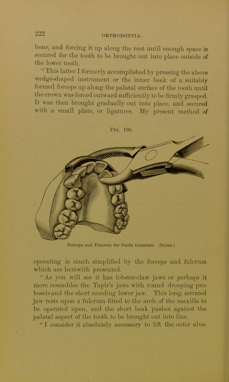 ORTHODONTIA. bone, and forcing it up along the root until enough space is secured tor the tooth to be brought out into place outside of the lower tooth. “ This latter I formerly accomplished by pressing the above wedge-shaped instrument or the inner beak of a suitably formed forceps up along the palatal surface of the tooth until the crown was forced outward sufficiently to be firmly grasped. It was then brought gradually out into place, and secured with a small plate, or ligatures. My present method of Fig. 190. Forceps and Fulcrum for Tooth Luxation. (Bryan.) operating is much simplified by the forceps and fulcrum which are herewith presented. “ As you will see it has lobster-claw jaws or perhaps it more resembles the Tapir’s jaws with round drooping pro- boscis and the short receding lower jaw. This long, serrated jaw rests upon a fulcrum fitted to the arch of the maxilla to be operated upon, and the short beak pushes against the palatal aspect of the tooth to be brought out into line. “ I consider it absolutely necessary to lift the outer alve-