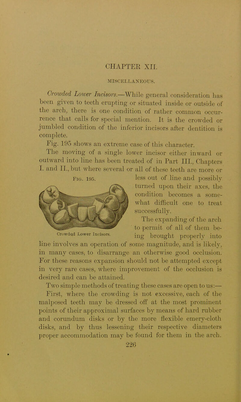 MISCELLANEOUS. Crowded Lower Incisors.—While general consideration has been given to teeth erupting or situated inside or outside of the arch, there is one condition of rather common occur- rence that calls for special mention. It is the crowded or jumbled condition of the inferior incisors after dentition is complete. Fig. 195 shows an extreme case of this character. The moving of a single lower incisor either inward or outward into line has been treated of in Part III., Chapters I. and II., but where several or all of these teeth are more or Fig. 195. less out of line and possibly turned upon their axes, the condition becomes a some- what difficult one to treat successfully. The expanding of the arch to permit of all of them be- Crowdejd Lower Incisors. i ng brought properly into line involves an operation of some magnitude, and is likely, in many cases, to disarrange an otherwise good occlusion. For these reasons expansion should not be attempted except in very rare cases, where improvement of the occlusion is desired and can be attained. Two simple methods of treating these cases are open to us:— First, where the crowding is not excessive, each of the malposed teeth may be dressed off at the most prominent points of their approximal surfaces by means of hard rubber and corundum disks or by the more flexible emery-cloth disks, and by thus lessening their respective diameters proper accommodation may be found for them in the arch.