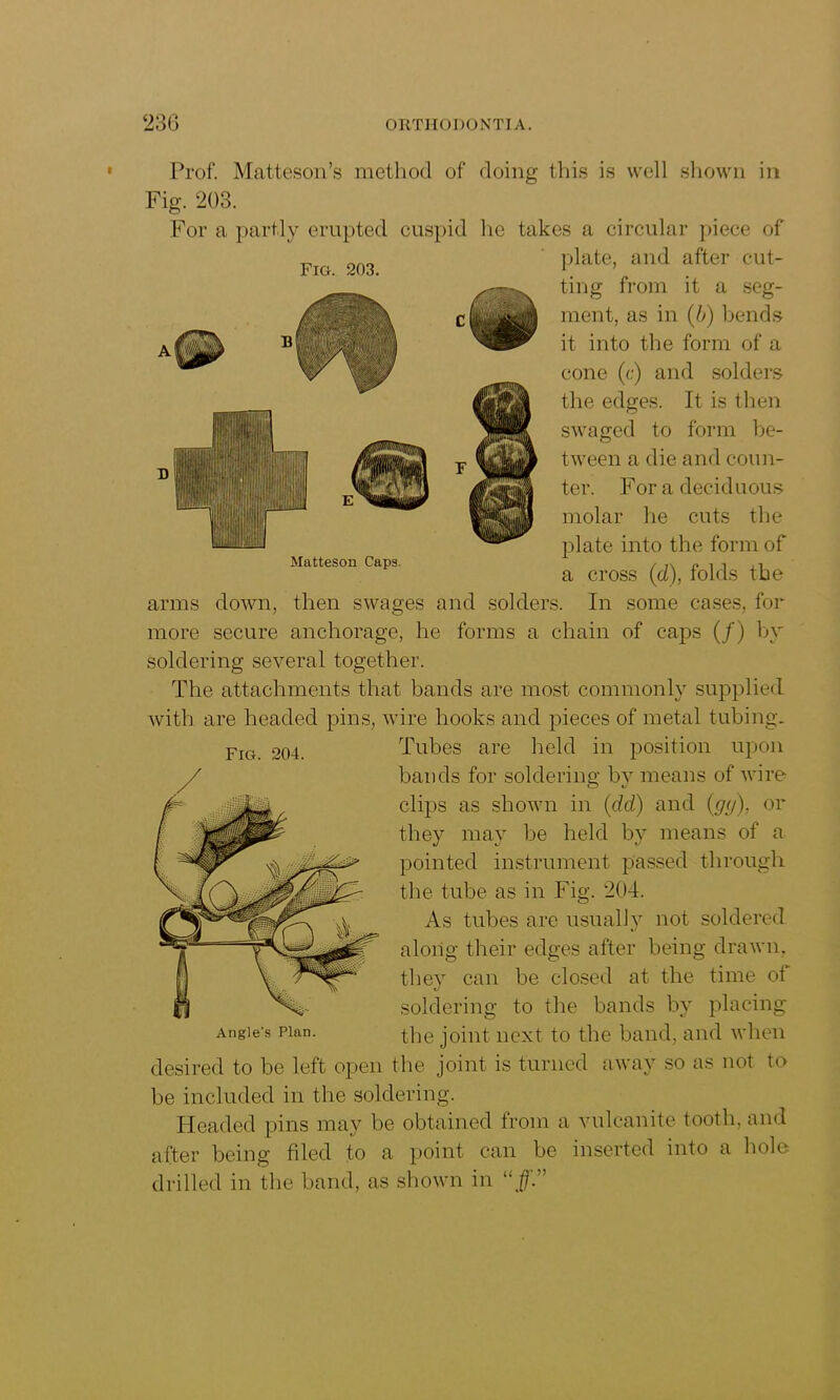 FlO. 203. Matteson Capa. Prof. Matteson’s method of doing this is well shown in Fig. 203. For a partly erupted cuspid he takes a circular piece of plate, and after cut- ting from it a seg- ment, as in (b) bends it into the form of a cone (c) and solders the edges. It is then swaged to form be- tween a die and coun- ter. For a deciduous molar he cuts the plate into the form of a cross (d), folds the arms down, then swages and solders. In some cases, for more secure anchorage, he forms a chain of caps (/) by soldering several together. The attachments that bands are most commonly supplied with are headed pins, wire hooks and pieces of metal tubing. Fro OQ4. Tubes are held in position upon bands for soldering by means of wire clips as shown in (dd) and (gy), or they may be held by means of a pointed instrument passed through the tube as in Fig. 204. As tubes are usually not soldered along their edges after being drawn, they can be closed at the time of soldering to the bands by placing the joint next to the band, and when desired to be left open the joint is turned away so as not to be included in the soldering. Headed pins may be obtained from a vulcanite tooth, and after being filed to a point can be inserted into a hole drilled in the band, as shown in “ff” Angle's Plan.