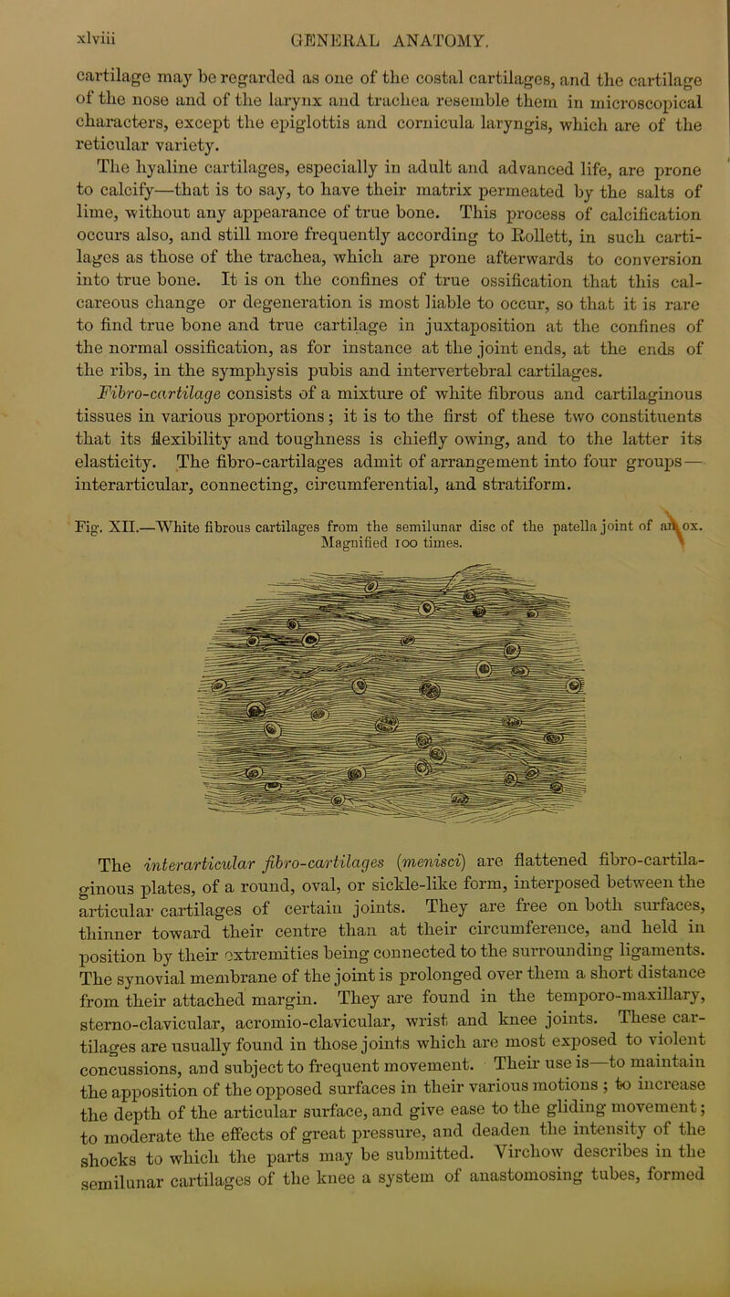 cartilage may be regarded as one of the costal cartilages, and the cartilage of the nose and of the larynx and trachea resemble them in microscopical characters, except the epiglottis and cornicula laryngis, which are of the reticular variety. The hyaline cartilages, especially in adult and advanced life, are prone to calcify—that is to say, to have their matrix permeated by the salts of lime, without any appearance of true bone. This process of calcification occurs also, and still more frequently according to Rollett, in such carti- lages as those of the trachea, which are prone afterwards to conversion into true bone. It is on the confines of true ossification that this cal- careous change or degeneration is most liable to occur, so that it is rare to find true bone and true cartilage in juxtaposition at the confines of the normal ossification, as for instance at the joint ends, at the ends of the ribs, in the symphysis pubis and intervertebral cartilages. Fibro-cartilage consists of a mixture of white fibrous and cartilaginous tissues in various proportions; it is to the first of these two constituents that its flexibility and toughness is chiefly owing, and to the latter its elasticity. The fibro-cartilages admit of arrangement into four groups — interarticular, connecting, circumferential, and stratiform. Fig. XII.—White fibrous cartilages from the semilunar disc of the patella joint of art ox. Magnified ioo times. The interarticular fibro-cartilages (menisci) are flattened fibro-cartila- ginous plates, of a round, oval, or sickle-like form, interposed between the articular cartilages of certain joints. They are free on both suifaces, thinner toward their centre than at their circumference, and held in position by their extremities being connected to the surrounding ligaments. The synovial membrane of the joint is prolonged over them a short distance from their attached margin. They are found in the temporo-maxillary, sterno-clavicular, acromio-clavicular, wrist and knee joints. These cai- tilages are usually found in those joints which are most exposed to violent concussions, and subject to frequent movement. Their use is to maintain the apposition of the opposed surfaces in their various motions ; to increase the depth of the articular surface, and give ease to the gliding movement; to moderate the effects of great pressure, and deaden the intensity of the shocks to which the parts may be submitted. Yircliow describes in the semilunar cartilages of the knee a system of anastomosing tubes, formed