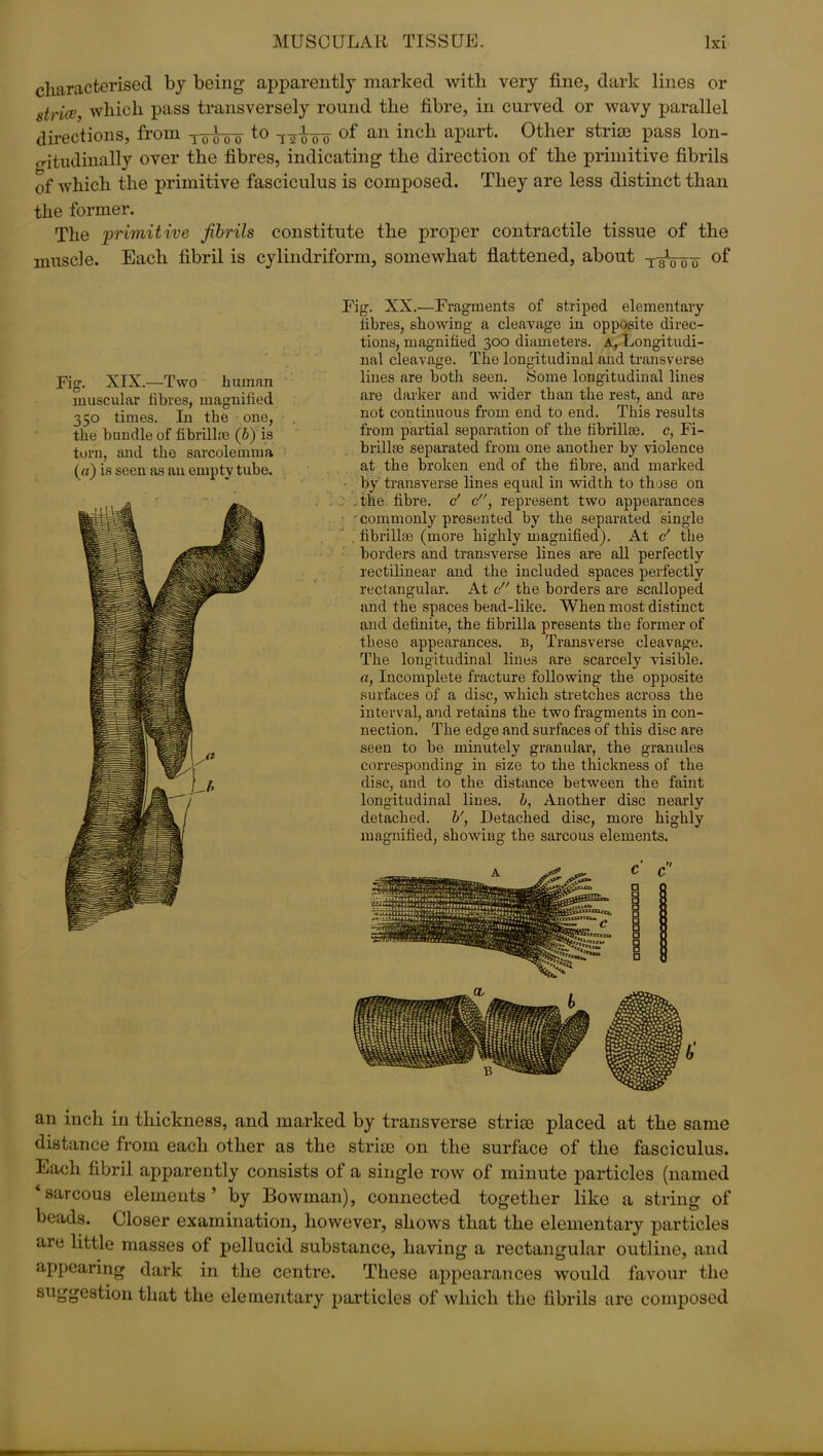 characterised by being apparently marked with very fine, dark lines or strice, which pass transversely round the fibre, in curved or wavy parallel directions, from T^ro to -j^oo of an inclx aPart- Other striae pass lon- gitudinally over the fibres, indicating the direction of the primitive fibrils of which the primitive fasciculus is composed. They are less distinct than the former. The ‘primitive fibrils constitute the proper contractile tissue of the muscle. Each fibril is cylindriform, somewhat flattened, about of Fig. XIX.—Two human muscular fibres, magnified 350 times. In the one, the bundle of fibrillin (b) is torn, and the sarcolemma («) is seen as an empty tube. Fig. XX.—Fragments of striped elementary fibres, showing a cleavage in opposite direc- tions, magnified 300 diameters. A, Longitudi- nal cleavage. The longitudinal and transverse lines are both seen. Some longitudinal lines are darker and wider than the rest, and are not continuous from end to end. This results from partial separation of the fibrillse. c, Fi- brillin separated from one another by violence at the broken end of the fibre, and marked by transverse lines equal in width to those on the fibre, c' c, represent two appearances ■ commonly presented by the separated single fibrillin (more highly magnified). At c' the borders and transverse lines are all perfectly rectilinear and the included spaces perfectly rectangular. At c the borders are scalloped and the spaces bead-like. When most distinct and definite, the fibrilla presents the former of these appearances. B, Transverse cleavage. The longitudinal lines are scarcely visible. a, Incomplete fracture following the opposite surfaces of a disc, which stretches across the interval, and retains the two fragments in con- nection. The edge and surfaces of this disc are seen to be minutely granular, the granules corresponding in size to the thickness of the disc, and to the distance between the faint longitudinal lines, b, Another disc nearly detached, b', Detached disc, more highly magnified, showing the sarcous elements. an inch in thickness, and marked by transverse strise placed at the same distance from each other as the strise on the surface of the fasciculus. Each fibril apparently consists of a single row of minute particles (named ‘sarcous elements’ by Bowman), connected together like a string of beads. Closer examination, however, shows that the elementary particles are little masses of pellucid substance, having a rectangular outline, and appearing dark in the centre. These appearances would favour the suggestion that the elementary particles of which the fibrils are composed