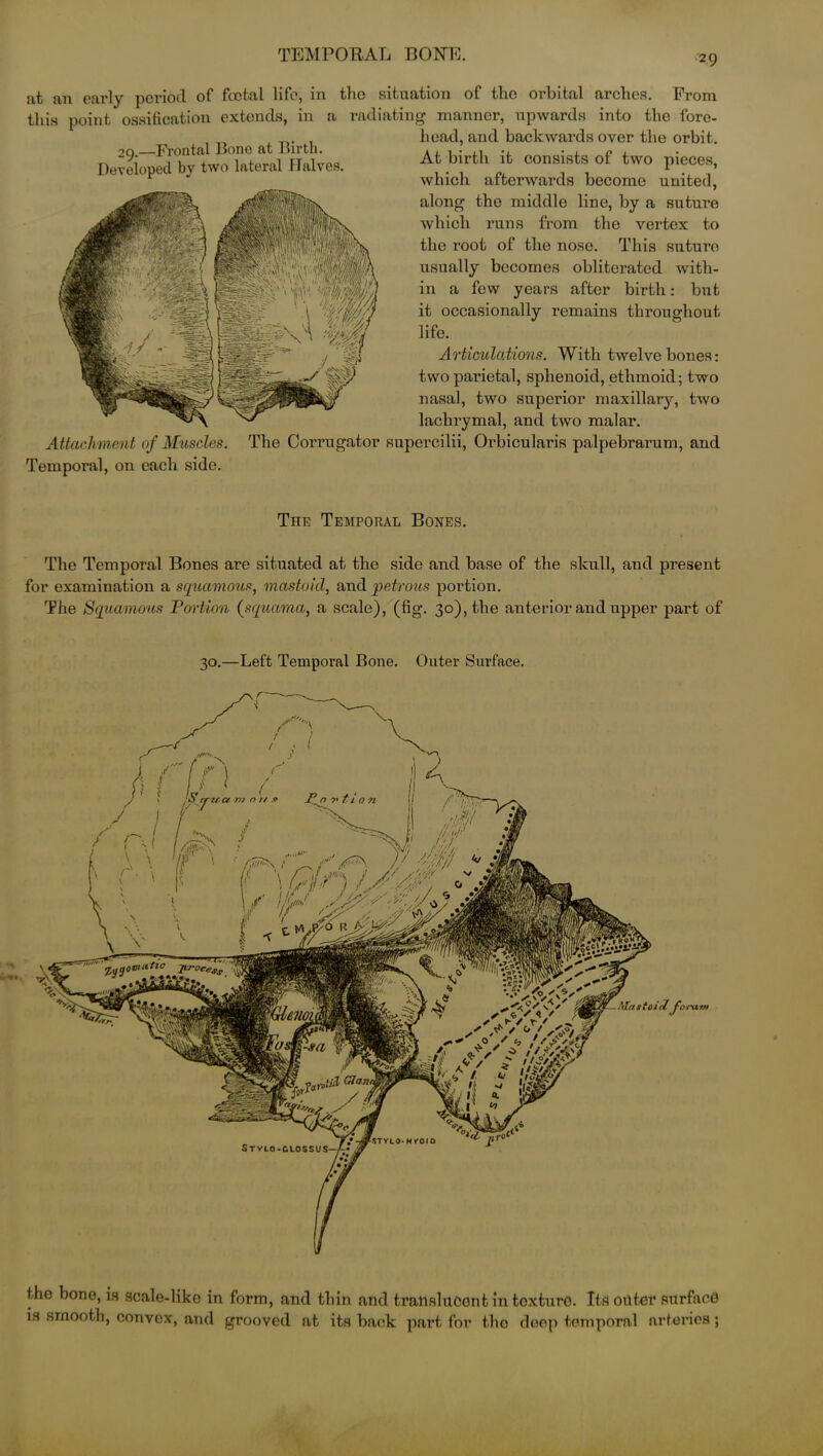 at an early period of foetal life, in tho situation of tho orbital arches. From this point ossification extends, in a radiating manner, upwards into the fore- head, and backwards over the orbit. 29.—Frontal Bone at Birth. Developed by two lateral Halves. At birth it consists of two pieces, which afterwards become united, along the middle line, by a suture which runs from the vertex to the root of the nose. This suture usually becomes obliterated with- in a few years after birth: but it occasionally remains throughout life. Articulations. With twelve bones: two parietal, sphenoid, ethmoid; two nasal, two superior maxillary, two lachrymal, and two malar. Attachment of Muscles. The Corrugator supercilii, Orbicularis palpebrarum, and Temporal, on each side. The Temporal Bones. The Temporal Bones are situated at the side and base of the skull, and present for examination a squamous, mastoid, and petrous portion. The Squamous Portion (squama, a scale), (fig. 30), the anterior and upper part of 30.—Left Temporal Bone. Outer Surface. ,gVuitic Jirocc# Mastoid fc STYLO- hyoid Stylo-glossi/s- the bone, is scale-like in form, and thin and translucent in texture. Its outer surface is smooth, convex, and grooved at its back part for tho deep temporal arteries;