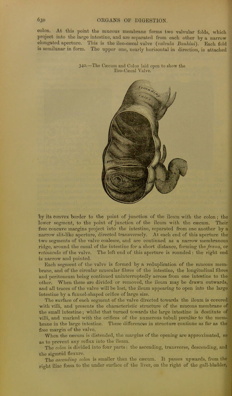 colon. At tliis point the mucous membrano forms two valvular folds, which project into tho largo intestine, and are separated from each other by a narrow olongated aperture. This is the ileo-coacal valve (valvula Bauhi/ni). Each fold is semilunar in form. Tho upper one, nearly horizontal in direction, is attached 34°-—The Caecum and Colon laid open to show the Ileo-Caecal Valve. by its convex border to the point of junction of the ileuln with the colon; the lower segment, to the point of junction of the ileum with the caecum. Their free concave margins project into the intestine, separated from one another by a narrow slit-like aperture, directed transversely. At each end of this aperture the two segments of the valve coalesce, and are continued as a narrow membranous ridge, around the canal of the intestine for a short distance, forming thefrcena, or retinacula of the valve. The left end of this aperture is rounded : the right end is narrow and pointed. Each segment of the valve is formed by a reduplication of the mucous mem- brane, and of the circular muscular fibres of the intestine, the longitudinal fibres and peritoneum being continued uninterruptedly across from one intestine to the other. When these are divided or removed, the ileum may be drawn outwards, and all traces of the valve will be lost, the ileum appearing to open into the large intestine by a funnel-shaped orifice of large size. The surface of each segment of the valve directed towaixls tlin ileum, is covered with villi, and presents the characteristic structure of the mucous membrane of the small intestine ; whilst that turned towards the large intestine is destitute of villi, and marked with the orifices of the numerous tubuli peculiar to the mem- brane in the large intestine. These differences in structure continue as far as the free margin of the valve. When the caecum is distended, the margins of the opening are approximated, so as to prevent any reflux into the ileum. The colon is divided into four parts: tho ascending, transverse, descending, and the sigmoid flexure. The ascending colon is smaller than the caecum. It passes upwards, from tlio right iliac fossa to the under surface of the liver, on the right of the gall-bladder,