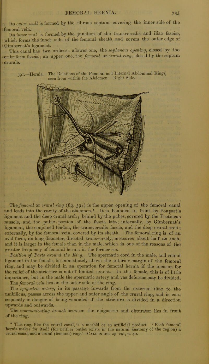 Its miter wall is formed by the fibrous septum covering the inner side of the femoral vein. Its inner wall is formed by the junction of the transversalis and iliac fasciae, which forms the inner side of the femoral sheath, and covers the outer edge of ' Gimbernat’s ligament. This canal has two orifices: a lower one, the saphenous opening, closed by the cribriform fascia; an upper one, the femoral or crural ring, closed by the septum cruralo. , ) 291. Hernia. The Relations of the Femoral and Internal Abdominal Rings, seen from within the Abdomen. Right Side. The femoral or crural ring (fig. 391) is the upper opening of the femoral canal and leads into the cavity of the abdomen.* It is bounded in front by Poupart’s ligament and the deep crural arch ; behind by the pubes, covered by the Pectineus muscle, and the pubic portion of the fascia lata; internally, by Gimbernat’s ligament, the conjoined tendon, the transversalis fascia, and the deep crural arch ; externally, by the femoral vein, covered by its sheath. The femoral ring is of an oval form, its long diameter, directed transversely, measures about half an inch, and it is larger in the female than in the male, which is one of the reasons of the greater frequency of femoral hernia in the former sex. Position of Parts around the Ring. The spermatic cord in the male, and round ligament in the female, lie immediately above the anterior margin of the femoral ring, and may be divided in an operation for femoral hernia if the incision for the relief of the stricture is not of limited extent. In the female, this is of little importance, but in the male the spermatic artery and vas deferens may be divided. The femoral vein lies on the outer side of the ring. The epigastric artery, in its passage inwards from the external iliac to the umbilicus, passes across the upper and outer angle of the crural ring, and is con- sequently in danger of being wounded if the stricture is divided in a direction upwards and outwards. The communicating branch between tho epigastric and obturator lies in front of the ring. * This ring, like the crural canal, is a morbid or an artificial product. 1 Each femoral hernia makes for itself (for neither outlet exists in tho natural anatomy of tho rogion) a crural canal, and a crural (femoral) ring.’—Callender, op. cit., p. 40.
