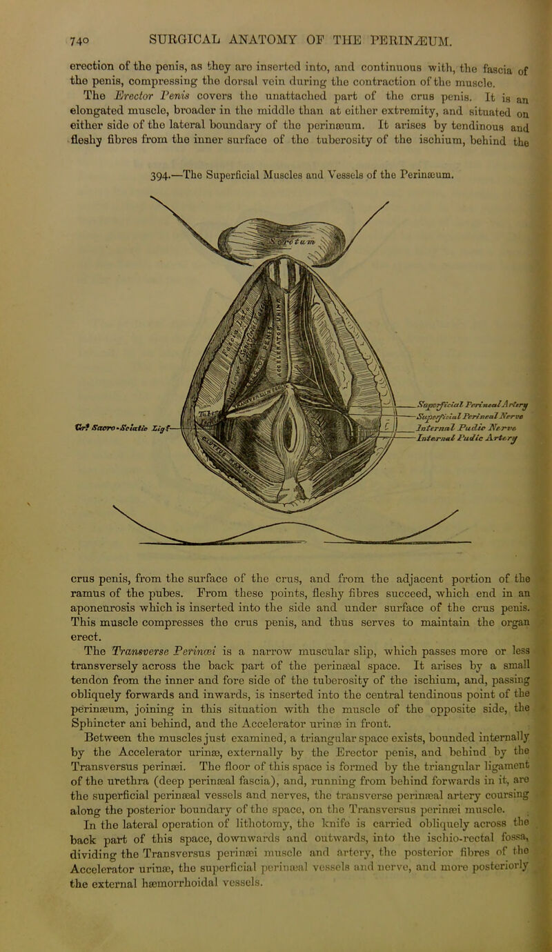 erection of tho penis, as they arc inserted into, and continuous with, the fascia of tho penis, compressing tho dorsal vein during the contraction of the muscle. The Erector Penis covers the unattached part of the crus penis. It is an elongated musclo, broader in the middle than at either extremity, and situated on either sido of the lateral boundary of tho perinooum. It arises by tendinous and fleshy fibres from tho inner surfaco of tho tuberosity of the ischium, behind the 394.—The Superficial Muscles and Vessels of the Perinseum. crus penis, from the surface of the crus, and from the adjacent poi'tion of the ramus of the pubes. From these points, fleshy fibres succeed, which end in an aponeurosis which is inserted into the side and under surface of the crus penis. This muscle compresses the crus penis, and thus serves to maintain the organ erect. The Transverse Penned is a narrow muscular slip, which passes more or less transversely across the back part of the perinatal space. It arises by a small tendon from the inner and fore side of the tuberosity of the ischium, and, passing obliquely forwards and inwai’ds, is inserted into the central tendinous point of the perinaeum, joining in this situation with the muscle of the opposite side, the Sphincter ani behind, and the Accelerator urinte in front. Between the muscles just examined, a triangular space exists, bounded internally by the Accelerator urinae, externally by the Erector penis, and behind by the Transversus perinaei. The floor of this space is formed by the triangular ligament of the urethra (deep perinoeal fascia), and, running from behind forwards in it, are the superficial perinaeal vessels and nerves, the transverse perinaeal artery coursing along the posterior boundary of the space, on the Transversus perinaei muscle. In the lateral operation of lithotomy, the knife is carried obliquely across the back part of this space, downwards and outwards, into the ischio-rectal fossa, dividing the Transversus perinaei muscle and artery, the posterior fibres of the Accelerator urinae, the superficial perinaeal vessels and nerve, and more posteriorly the external haemorrhoidal vessels.