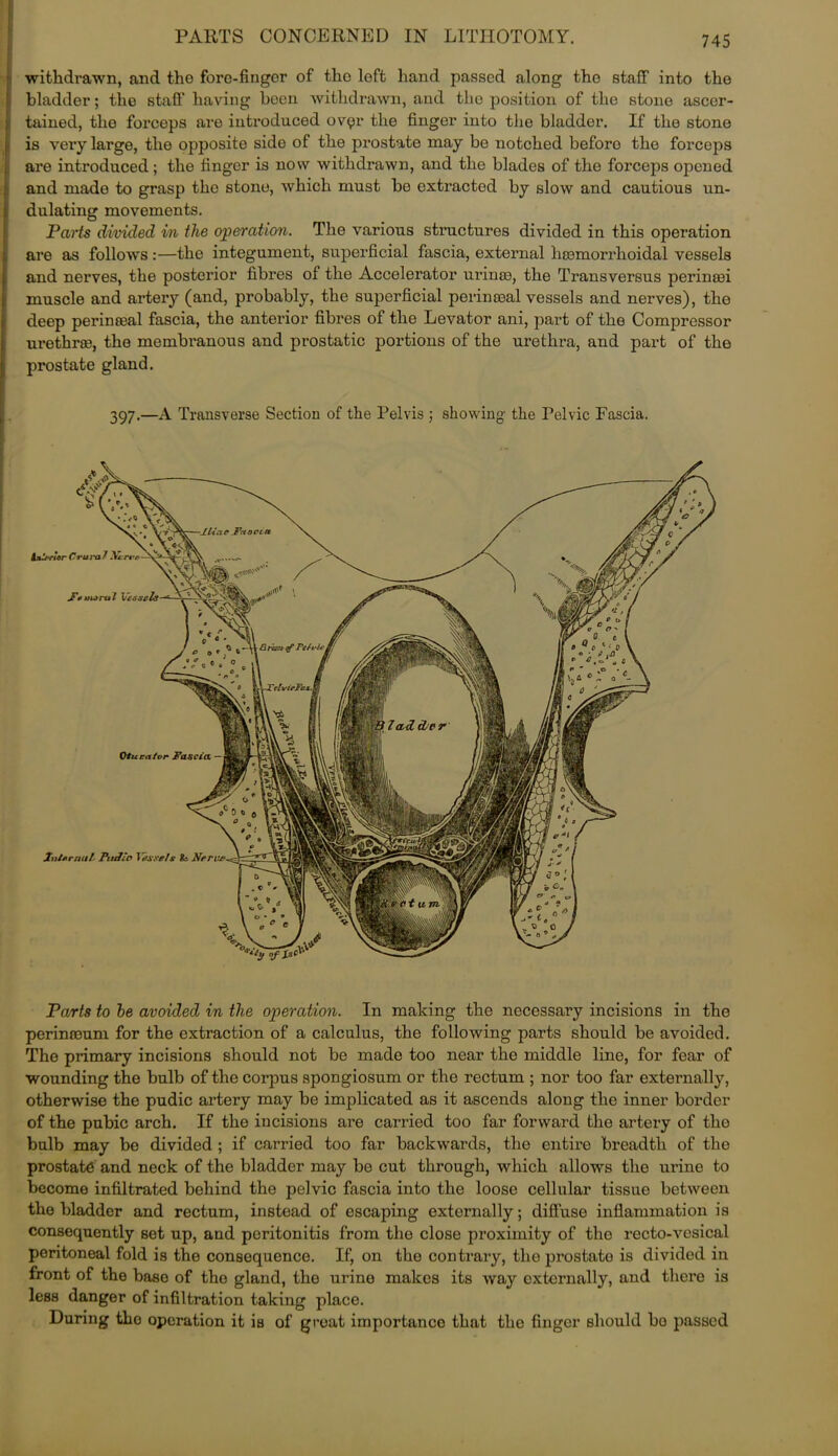 PARTS CONCERNED IN LITHOTOMY. withdrawn, and the fore-finger of the left hand passed along tho staff into the bladder; the staff having been withdrawn, and the position of the stone ascer- tained, the forceps are introduced ovgr the finger into the bladder. If the stone is vei’y large, the opposite side of the prostate may be notched beforo the forceps are introduced; the finger is now withdrawn, and the blades of the forceps opened and made to grasp the stone, which must be extracted by slow and cautious un- dulating movements. Parts divided in the operation. The various structures divided in this operation are as follows:—the integument, superficial fascia, external licomorrhoidal vessels and nerves, the posterior fibres of the Accelerator urinse, the Transversus perinaai muscle and artery (and, probably, the superficial perinoaal vessels and nerves), the deep perinceal fascia, the anterior fibres of the Levator ani, part of the Compressor urethrae, the membranous and prostatic portions of the urethra, and part of the prostate gland. 397.—A Transverse Section of the Pelvis ; showing the Pelvic Fascia. Parts to he avoided in the operation. In making the necessary incisions in the perinooum for the extraction of a calculus, the following parts should be avoided. The primary incisions should not be made too near the middle line, for fear of wounding the bulb of the corpus spongiosum or the rectum ; nor too far externally, otherwise the pudic artery may be implicated as it ascends along the inner border of the pubic arch. If the incisions are carried too far forward the artery of tho bulb may be divided ; if carried too far backwards, the entire breadth of the prostate and neck of the bladder may be cut through, which allows the mine to become infiltrated behind the pelvic fascia into the loose cellular tissue between tho bladder and rectum, instead of escaping externally; diffuse inflammation is consequently set up, and peritonitis from the close proximity of the recto-vesical peritoneal fold is the consequence. If, on the contrary, the prostate is divided in front of the base of the gland, the urine makes its way externally, and there is less danger of infiltration taking place. During tho operation it is of groat importance that the finger should bo passed