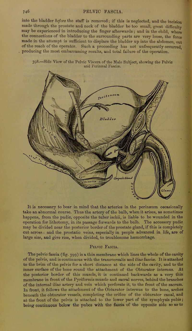into the bladder before the staff is removed; if this is neglected, and the incision made through the prostate and neck of the bladder be too small, great difficulty may be experienced in introducing the finger afterwards ; and in the child, where the connections of the bladder to the surrounding parts are very loose, the force made in the attempt is sufficient to displace the bladder up into the abdomen, out of the reach of the operator. Such a proceeding has not unfrequently occurred, producing the most embarrassing results, and total failure of the operation. 398.—Side View of the Pelvic Viscera of the Male Subject, showing the Pelvic and Perinseal Fasciso. It is necessary to bear in mind that the arteries in the perinasum occasionally take an abnormal course. Thus the artery of the bulb, when it arises, as sometimes happens, from the pudic, opposite the tuber ischii, is liable to be wounded in the operation for lithotomy, in its passage forwards to the bulb. The accessory pudic may be divided near the posterior border of the prostate gland, if this is completely cut across : and the prostatic veins, especially in people advanced in life, are of large size, and give rise, when divided, to troublesome haemorrhage. Pelvic Fascia. The pelvic fascia (fig. 399) is a thin membrane which lines the whole of the cavity of the pelvis, and is continuous with the transversalis and iliac fasciae. It is attached to the brim of the pelvis for a short distance at the side of the cavity, and to the inner surface of the bone round the attachment of the Obturator internus. At the posterior border of this muscle, it is continued backwards as a very thin membrane in front of the Pyriformis muscle and sacral nerves, behind the branches of the internal iliac artery and vein which perforate it, to the front of the sacrum. In front, it follows the attachment of the Obturator internus to the bone, arches beneath the obturator vessels, completing the orifice of the obturator canal, and at the front of the pelvis is attached to the lower part of the symphysis pubis; being continuous below the pubes with the fascia of tho opposite side so as to