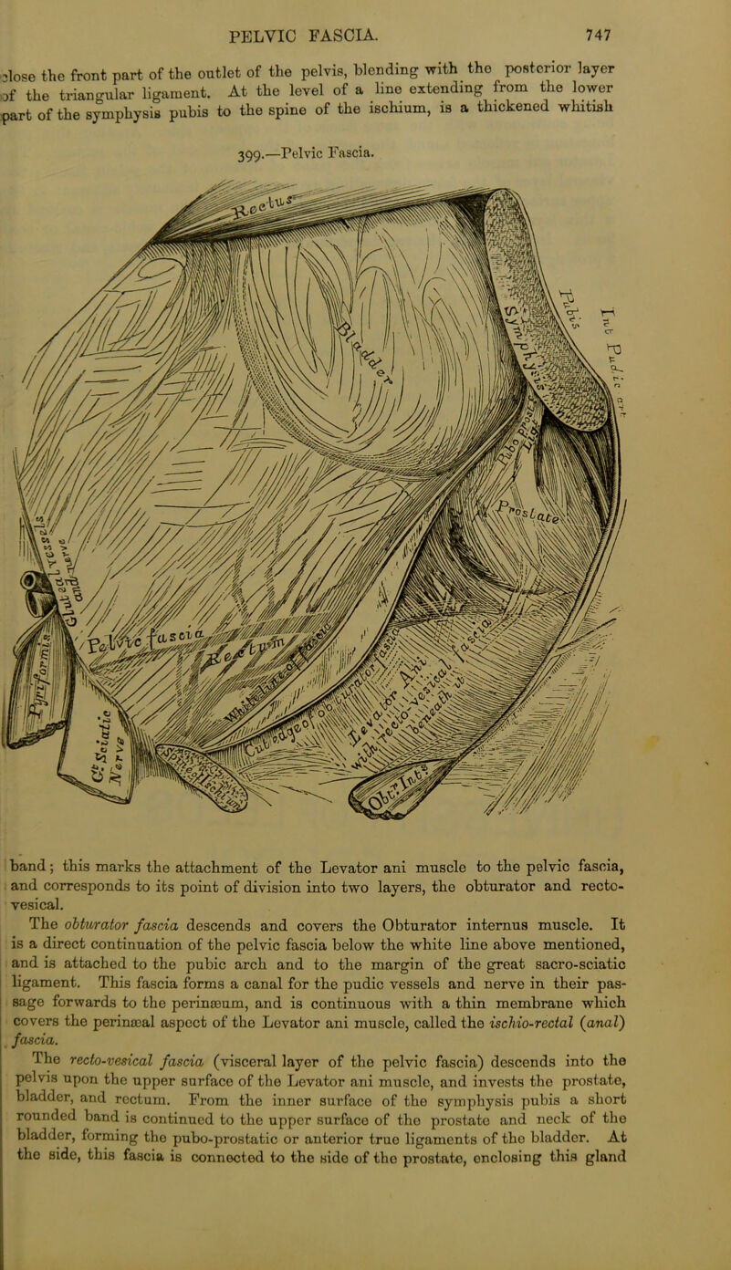 olose the front part of the outlet of the pelvis, blending with the posterior layer of the triangular ligament. At the level of a line extending from the lower part of the symphysis pubis to the spine of the ischium, is a thickened whitish 399.—Pelvic Fascia. band; this marks the attachment of the Levator ani muscle to the pelvic fascia, and corresponds to its point of division into two layers, the obturator and recto- vesical. The obturator fascia descends and covers the Obturator intemus muscle. It is a direct continuation of the pelvic fascia below the white line above mentioned, and is attached to the pubic arch and to the margin of the great sacro-sciatic ligament. This fascia forms a canal for the pudic vessels and nerve in their pas- sage forwards to the perinseum, and is continuous with a thin membrane which covers the perinatal aspect of the Levator ani muscle, called the ischio-redal (anal) fascia. The recto-vesical fascia (visceral layer of the pelvic fascia) descends into the pelvis upon the upper surface of the Levator ani muscle, and invests the prostate, bladder, and rectum. From the inner surface of the symphysis pubis a short rounded band is continued to the upper surface of the prostato and neck of the bladder, forming the pubo-prostatic or anterior true ligaments of the bladder. At the side, this fascia is connected to the side of the prostato, enclosing this gland