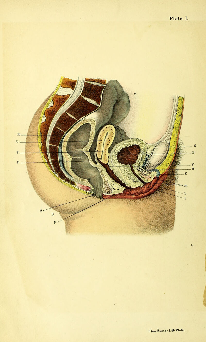 Plate L Thos Hunter,Lith Phila.