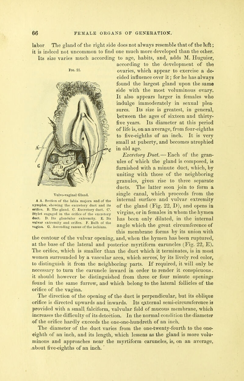 labor The gland of the right side does not always resemble that of the left; it is indeed not uncommon to find one much more developed than the oiher. Its size varies much according to age, habits, and, adds M. Huguier, according to the development of tho ovaries, which appear to exercise a de- cided influence over it; for he lias always found the largest gland upon the same side with the most voluminous ovary. It also appears larger in females who indulge immoderately in sexual plea- sures. Its size is greatest, in general, between the ages of sixteen and thirty- five years. Its diameter at this period of life is, on an average, from four-eighths to five-eighths of an inch. It is very small at puberty, and becomes atrophied in old age. Excretory Duct. — Each of the gran- ules of which the gland is composed, is furnished with a minute duct, which, by uniting with those of the neighboring granules, gives rise to three separate ducts. The latter soon join to form a single canal, which proceeds from the internal surface and vulvar extremity of the gland (Fig. 22, D), and opens in virgins, or in females in whom the hymen has been only dilated, in the internal angle which the great circumference of this membrane forms by its union with the contour of the vulvar opening, and, when the hymen has been ruptured, at the base of the lateral and posterior myrtiform caruncles (Fig. 22, E). The orifice, which is smaller than the duct which it terminates, is in most women surrounded by a vascular area, which serves, by its lively red color, to distinguish it from the neighboring parts. If required, it will only be necessary to turn the caruncle inward in order to render it conspicuous. It should however be distinguished from three or four minute openings found in the same furrow, and which belong to the lateral follicles of the orifice of the vagina. The direction of the opening of the duct is perpendicular, but its oblique orifice is directed upwards and[ inwards. Its qpcternal semi-circumference is provided with a small falciform, valvular fold of mucous membrane, which increases the difiiculty of its detection. In the normal condition the diameter of the orifice hardly exceeds the one-one-hundreth of an inch. The diameter of the duct varies from the one-twenty-fourth to the one- eighth of an inch, and its length, which lessens as the gland is more volu- minous and approaches near the myrtiform caruncles, is, on an average, .about five-eighths of an inch.' Fig. 22. Tulvo-vaginal Gland. A A. Section of the labia majora and of the nymplias, showing the excretory duct and its orifice. B. The gland. C. Excretory duct. C. Stylet engaged in the orifice of the excretory duct. D. Its glandular extremity. E. Its vulvar extremity and orifice. F. Bulb of the vagina. G. Ascending ramus of the ischium.