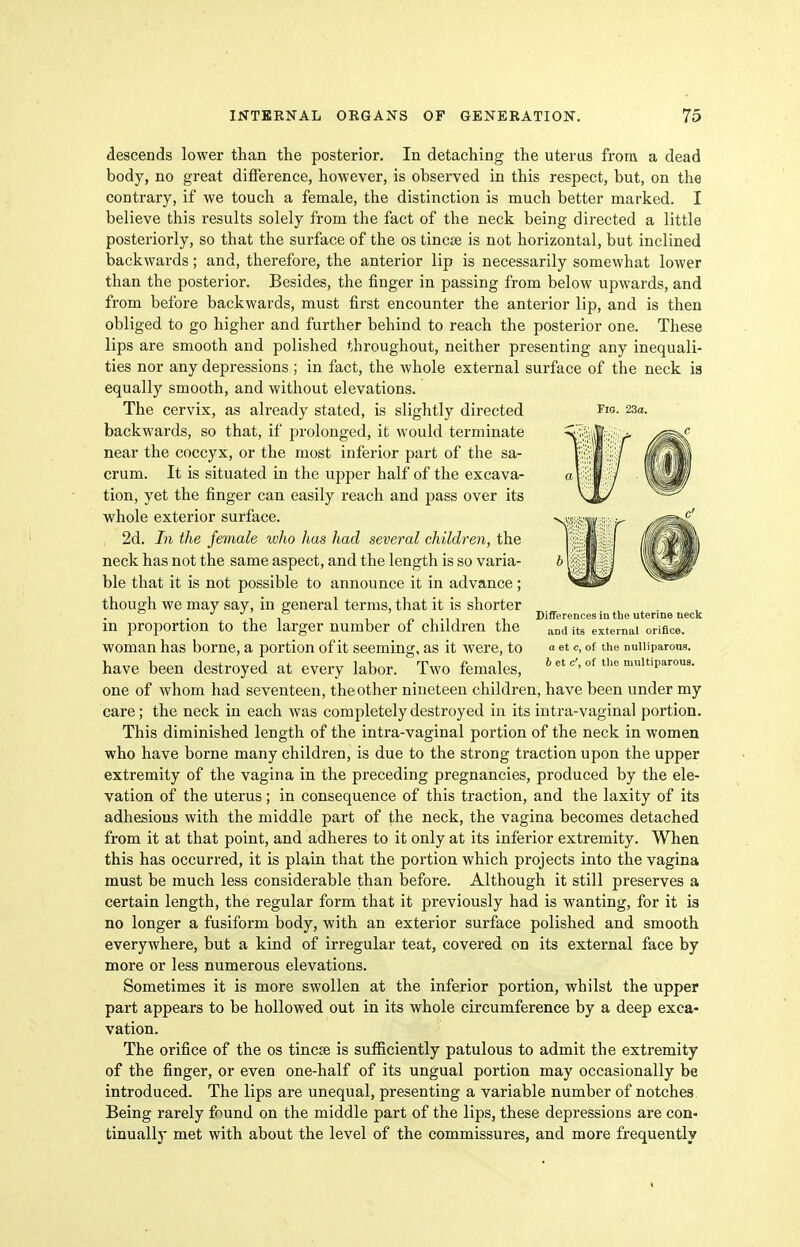 descends lower than the posterior. In detaching the uterus from a dead body, no great difference, however, is observed in this respect, but, on the contrary, if we touch a female, the distinction is much better marked. I believe this results solely from the fact of the neck being directed a little posteriorly, so that the surface of the os tincse is not horizontal, but inclined backwards; and, therefore, the anterior lip is necessarily somewhat lower than the posterior. Besides, the finger in passing from below upwards, and from before backwards, must first encounter the anterior lip, and is then obliged to go higher and further behind to reach the posterior one. These lips are smooth and polished throughout, neither presenting any inequali- ties nor any depressions ; in fact, the whole external surface of the neck is equally smooth, and without elevations. The cervix, as already stated, is slightly directed fig. 230. backwards, so that, if prolonged, it would terminate near the coccyx, or the most inferior part of the sa- crum. It is situated in the upper half of the excava- tion, yet the finger can easily reach and pass over its whole exterior surface. 2d. In the female who has had several children, the neck has not the same aspect, and the length is so varia- ble that it is not possible to announce it in advance; though we may say, in general terms, that it is shorter • 1 1 1 1 •! 1 1 Differences in the uterine neck m proportion to the larger number of children the and its external orifice, woman has borne, a portion of it seeming, as it were, to «et c, of the nuiiiparous. have been destroyed at every labor. Two females, »ofii«parous. one of whom had seventeen, the other nineteen children, have been under my care; the neck in each was completely destroyed in its intra-vaginal portion. This diminished length of the intra-vaginal portion of the neck in women who have borne many children, is due to the strong traction upon the upper extremity of the vagina in the preceding pregnancies, produced by the ele- vation of the uterus; in consequence of this traction, and the laxity of its adhesions with the middle part of the neck, the vagina becomes detached from it at that point, and adheres to it only at its inferior extremity. When this has occurred, it is plain that the portion which projects into the vagina must be much less considerable than before. Although it still preserves a certain length, the regular form that it previously had is wanting, for it is no longer a fusiform body, with an exterior surface polished and smooth everywhere, but a kind of irregular teat, covered on its external face by more or less numerous elevations. Sometimes it is more swollen at the inferior portion, whilst the upper part appears to be hollowed out in its whole circumference by a deep exca- vation. The orifice of the os tincse is sufficiently patulous to admit the extremity of the finger, or even one-half of its ungual portion may occasionally be introduced. The lips are unequal, presenting a variable number of notches. Being rarely found on the middle part of the lips, these depressions are con- tinually met with about the level of the commissures, and more frequently