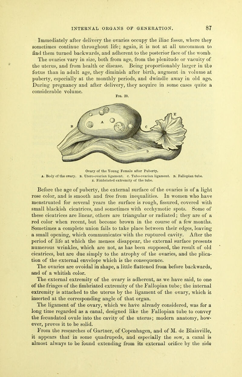 Immediately after delivery the ovaries occupy the iliac fossse, where they Bometimes continue throughout life; again, it is not at all uncommon to find them turned backwards, and adherent to the posterior face of the womb. The ovaries vary in size, both from age, from the plenitude or vacuity of the uterus, and from health or disease. Being proportionably larger in the foetus than in adult age, they diminish after birth, augment in volume at puberty, especially at the monthly periods, and dwindle away in old age. During pregnancy and after delivery, they acquire in some cases quite a considerable volume. Fio. 29. Ovary of the Young Female after Puberty. A. Body of the ovary. B. TJtero-ovarian ligament, c. Tubo-ovarian ligament. D. Fallopian tube. E. Fimbriated extremity of the tube. Before the age of puberty, the external surface of the ovaries is of a light rose color, and is smooth and free from inequalities. In women who have menstruated for several years the surface is rough, fissured, covered with small blackish cicatrices, and sometimes with ecchymotic spots. Some of these cicatrices are linear, others are triangular or radiated; they are of a red color when recent, but become brown in the course of a few months. Sometimes a complete union fails to take place between their edges, leaving a small opening, which communicates with the ruptured cavity. After the period of life at which the menses disappear, the external surface presents numerous wrinkles, which are not, as has been supposed, the result of old cicatrices, but are due simply to the atrophy of the ovaries, and the plica- tion of the external envelope which is the consequence. The ovaries are ovoidal in shape, a little flattened from before backwards, and of a whitish color. The external extremity of the ovary is adherent, as we have said, to one of the fringes of the fimbriated extremity of the Fallopian tube; the internal extremity is attached to the uterus by the ligament of the ovary, which is inserted at the corresponding angle of that organ. The ligament of the ovary, which we have already considered, was for a long time regarded as a canal, designed like the Fallopian tube to convey the fecundated ovule into the cavity of the uterus; modern anatomy, how- ever, proves it to be solid. From the researches of Gartner, of Copenhagen, and of M. de Blainville, it appears that in some quadrupeds, and especially the sow, a canal is almost always to be found extending from its external orifice by the side