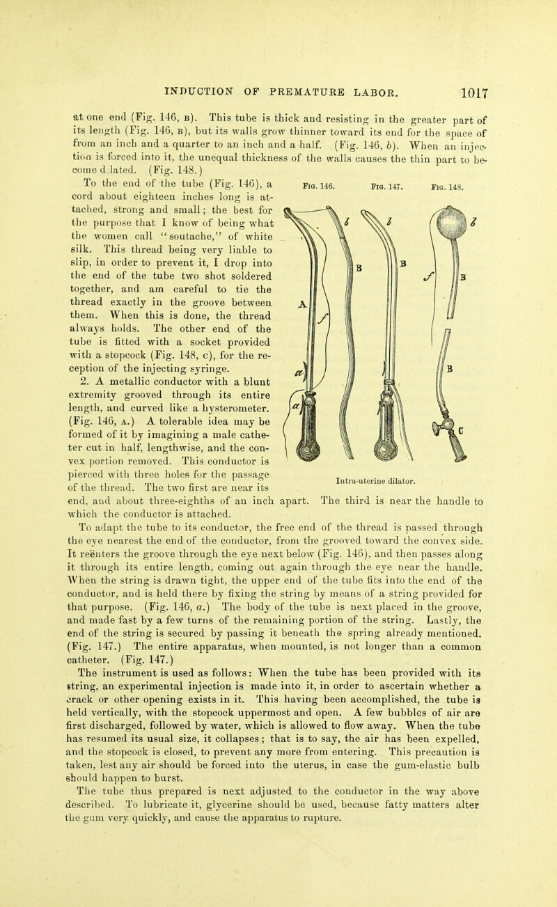 Fia. 146. Fig. 147. Fig. 148. at one end (Fig. 146, b). This tube is thick and resisting in the greater part of its length (Fig. 146, b), but its walls grow thinner toward its end for the space of from an inch and a quarter to an inch and a half. (Fig. 146, b). When an injec- tion is forced into it, the unequal thickness of the walls causes the thin part to be- come d.;lated. (Fig. 148.) To the end of the tube (Fig. 146), a cord about eighteen inches long is at- taclied, strong and small; the best for the purpose that I know of being what the women call soutache, of white silk. This thread being very liable to slip, in order to prevent it, I drop into the end of the tube two shot soldered together, and am careful to tie the thread exactly in the groove between them. When this is done, the thread always holds. The other end of the tube is fitted with a socket provided with a stopcock (Fig. 148, c), for the re- ception of the injecting syringe. 2. A metallic conductor with a blunt extremity grooved through its entire length, and curved like a hysterometer. (Fig. 146, A.) A tolerable idea may be formed of it by imagining a male cathe- ter cut in half, lengthwise, and the con- vex portion removed. This conductor is pierced with three holes for the pass<age of the thread. The two first are near its end, and about three-eighths of an inch apart. The third is near the handle to which the conductor is attached. To adapt the tube to its conductor, the free end of the thread is passed through the eye nearest the end of the conductor, from the grooved toward the convex side. It reenters the groove through the eye next below (Fig. 146), and then passes along it through its entire length, coming out again through the eye near the handle. When the string is drawn tight, the upper end of the tube fits into the end of the conductor, and is held there by fixing the string by means of a string provided for that purpose. (Fig. 146, a.) The body of the tube is next placed in the groove, and made fast by a few turns of the remaining portion of the string. Lastly, the end of the string is secured by passing it beneath the spring already mentioned. (Fig. 147.) The entire apparatus, when mounted, is not longer than a common catheter. (Fig. 147.) The instrument is used as follows: When the tube has been provided with its string, an experimental injection is made into it, in order to ascertain whether a crack or other opening exists in it. This having been accomplished, the tube ia held vertically, with the stopcock uppermost and open. A few bubbles of air are first discharged, followed by water, which is allowed to flow away. When the tube has resumed its usual size, it collapses; that is to say, the air has been expelled, and the stopcock is closed, to prevent any more from entering. This precaution is taken, lest any air should be forced into the uterus, in case the gum-elastic bulb should happen to burst. The tube thus prepared is next adjusted to the conductor in the way above described. To lubricate it, glycerine should be used, because fatty matters alter the gum very quickly, and cause the apparatus to rupture. Intra-uteriue dilator.