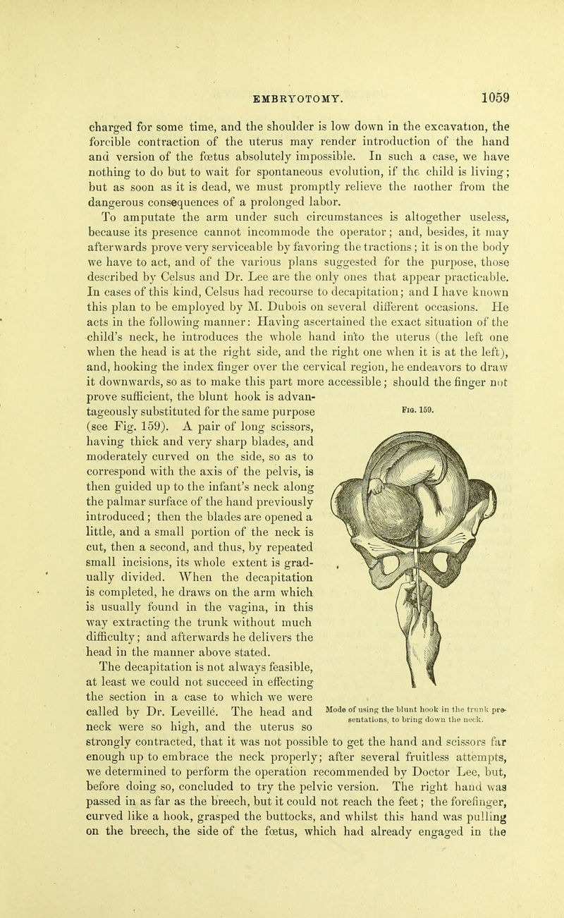 chai'ged for some time, and the shoulder is low down in the excavation, the forcible contraction of the uterus may render introduction of the hand and version of the foetus absolutely impossible. In such a case, we have nothing to do but to wait for spontaneous evolution, if the child is living; but as soon as it is dead, we must promptly relieve the iQother from the dangerous consequences of a prolonged labor. To amputate the arm under such circumstances is altogether useless, because its presence cannot incommode the operator; and, besides, it may afterwards prove very serviceable by favoring the tractions ; it is on the body we have to act, and of the various plans suggested for the purpose, those described by Celsus and Dr. Lee are the only ones that appear practicable. In cases of this kind, Celsus had recourse to decapitation; and I have known this plan to be employed by M. Dubois on several different occasions. He acts in the following manner: Having ascertained the exact situation of the •child's neck, he introduces the whole hand into the uterus (the left one when the head is at the right side, and the right one when it is at the left), and, hooking the index finger over the cervical region, he endeavors to draw it downwards, so as to make this part more accessible; should the finger not prove sufficient, the blunt hook is advan- tageously substituted for the same purpose Fia. 159. (see Fig. 159). A pair of long scissors, having thick and very sharp blades, and moderately curved on the side, so as to correspond with the axis of the pelvis, is then guided up to the infant's neck along the palmar surface of the hand previously introduced ; then the blades are opened a little, and a small portion of the neck is cut, then a second, and thus, by repeated small incisions, its whole extent is grad- ually divided. When the decapitation is completed, he draws on the arm which is usually found in the vagina, in this way extracting the trunk without much difficulty; and afterwards he delivei'S the head in the manner above stated. The decapitation is not always feasible, at least we could not succeed in effecting the section in a case to which we were called by Dr. Leveille. The head and Mode of using the bumt hook in ti.etmnkpre- , 1 • 1 11 seutations, to hring down the neck. neck were so high, and the uterus so strongly contracted, that it was not possible to get the hand and scissors far enough up to embrace the neck properly; after several fruitless attempts, we determined to perform the operation recommended by Doctor Lee, but, before doing so, concluded to try the pelvic version. The right hand was passed in as far as the breech, but it could not reach the feet; the forefinger, curved like a hook, grasped the buttocks, and whilst this hand was pulling on the breech, the side of the foetus, which had already engaged in the