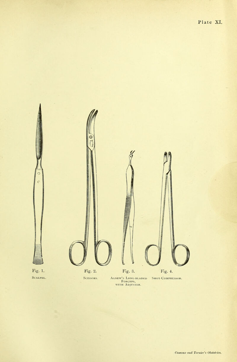 Fig. 1. Fig. 2. Fig. 3. Fig. 4. Scalpel. Scissors. Agnew's Long bladed Shot-Compkcssok. Forceps, wriH Adjuster.