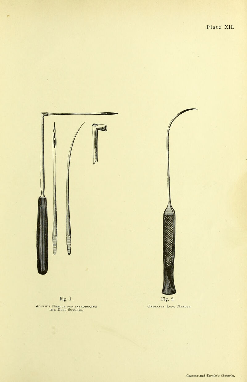 Fig. 1. Agnew's Needle for introducing THE Deep Sutures. Fig. 2. Ordinary Long Needle.