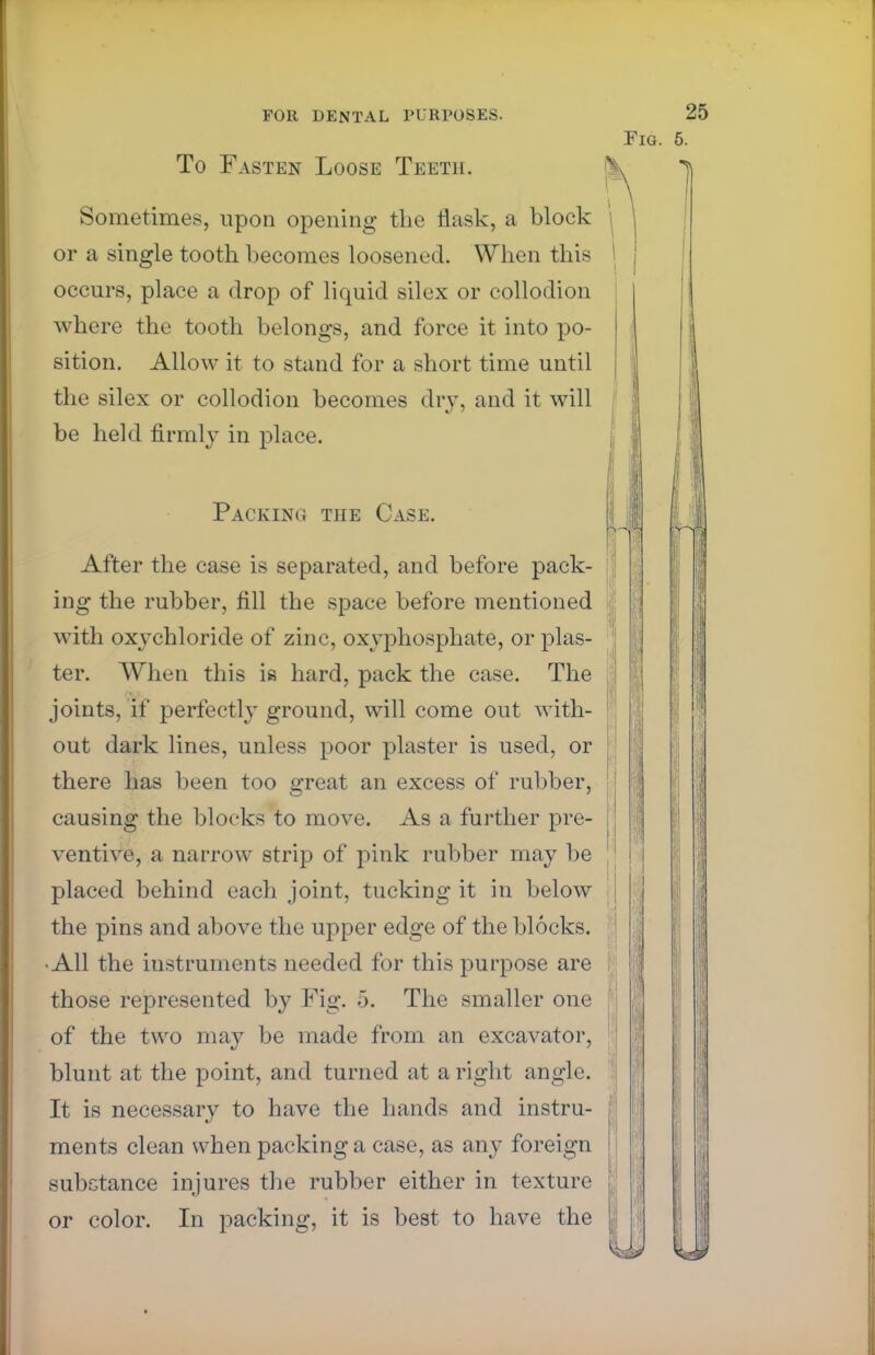 To Fasten Loose Teeth. Sometimes, upon opening the flask, a block or a single tooth becomes loosened. When this occurs, place a drop of liquid silex or collodion where the tooth belongs, and force it into po- sition. Allow it to stand for a short time until the silex or collodion becomes dry, and it will be held firmly in place. Packing the Case. After the case is separated, and before pack- ing the rubber, fill the space before mentioned with oxychloride of zinc, oxyphosphate, or plas- ter. When this is hard, pack the case. The joints, if perfectly ground, will come out with- out dark lines, unless poor plaster is used, or there has been too great an excess of rubber, causing the blocks to move. As a further pre- ventive, a narrow strip of pink rubber may be placed behind each joint, tucking it in below the pins and above the upper edge of the blocks. •All the instruments needed for this purpose are of the two may be made from an excavator, blunt at the point, and turned at aright angle. It is necessary to have the hands and instru- ments clean when packing a case, as any foreign substance injures the rubber either in texture or color. In packing, it is best to have the Fig