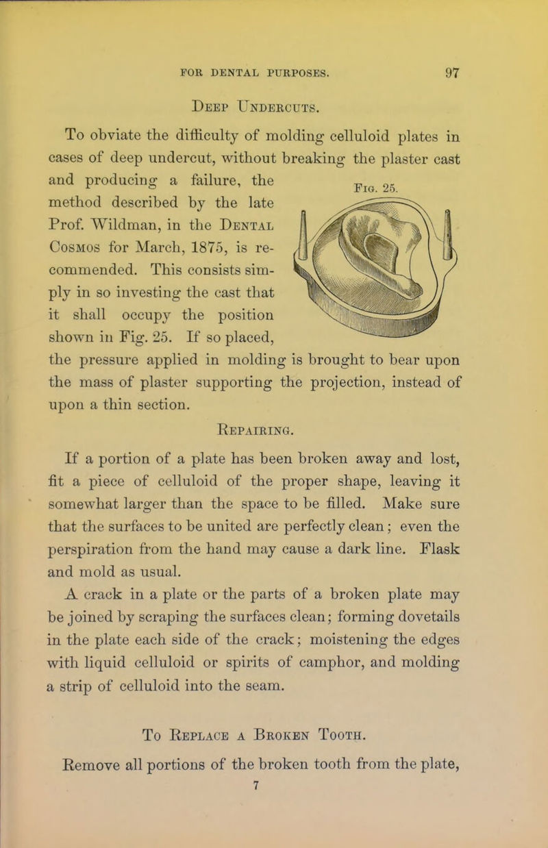 Deep Undercuts. To obviate the difficulty of molding celluloid plates in cases of deep undercut, without breaking the plaster cast and producing a failure, the method described by the late Prof. Wildman, in the Dental Cosmos for March, 1875, is re- commended. This consists sim- ply in so investing the cast that it shall occupy the position shown in Fig. 25. If so placed, the pressure applied in molding is brought to bear upon the mass of plaster supporting the projection, instead of upon a thin section. Repairing. If a portion of a plate has been broken away and lost, fit a piece of celluloid of the proper shape, leaving it somewhat larger than the space to be filled. Make sure that the surfaces to be united are perfectly clean; even the perspiration from the hand may cause a dark line. Flask and mold as usual. A crack in a plate or the parts of a broken plate may be joined by scraping the surfaces clean; forming dovetails in the plate each side of the crack; moistening the edges with liquid celluloid or spirits of camphor, and molding a strip of celluloid into the seam. To Replace a Broken Tooth. Remove all portions of the broken tooth from the plate, 7 Fig. 25.