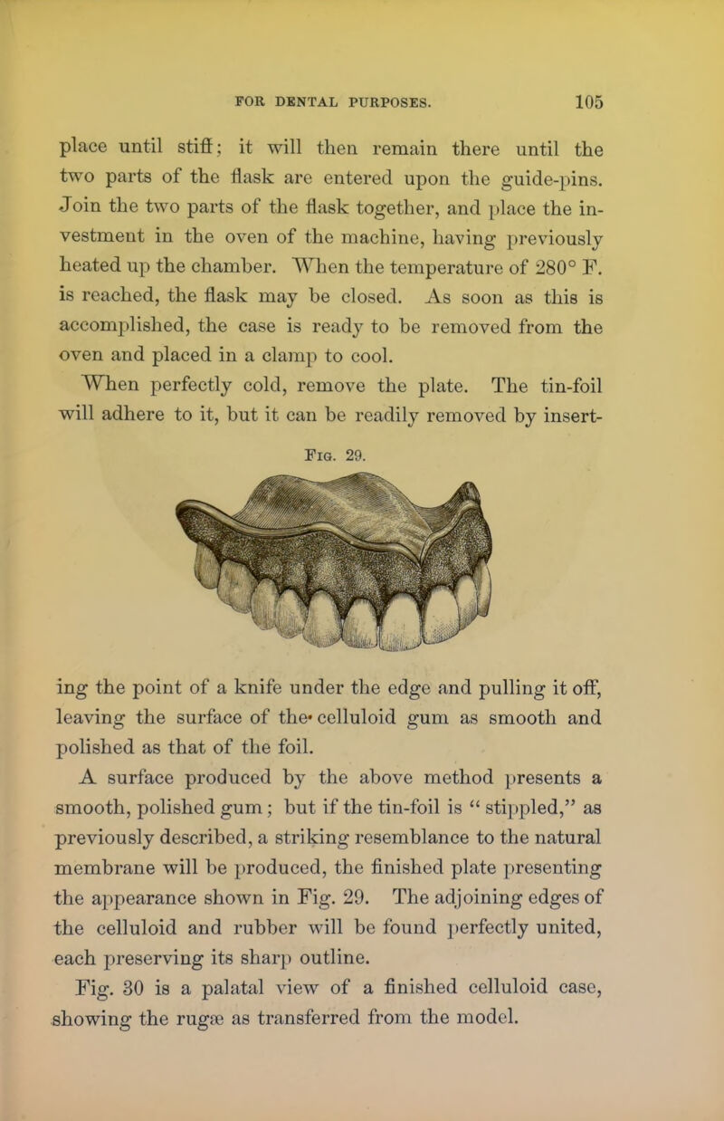 place until stiff; it will then remain there until the two parts of the flask are entered upon the guide-pins. Join the two parts of the flask together, and place the in- vestment in the oven of the machine, having previously heated up the chamber. When the temperature of 280° F. is reached, the flask may be closed. As soon as this is accomplished, the case is ready to be removed from the oven and placed in a clamp to cool. When perfectly cold, remove the plate. The tin-foil will adhere to it, but it can be readily removed by insert- Fig. 29. ing the point of a knife under the edge and pulling it off, leaving the surface of the* celluloid gum as smooth and polished as that of the foil. A surface produced by the above method presents a smooth, polished gum; but if the tin-foil is  stippled, as previously described, a striking resemblance to the natural membrane will be produced, the finished plate presenting the appearance shown in Fig. 29. The adjoining edges of the celluloid and rubber will be found perfectly united, each preserving its sharp outline. Fig. 30 is a palatal view of a finished celluloid case, showing the rugre as transferred from the model.