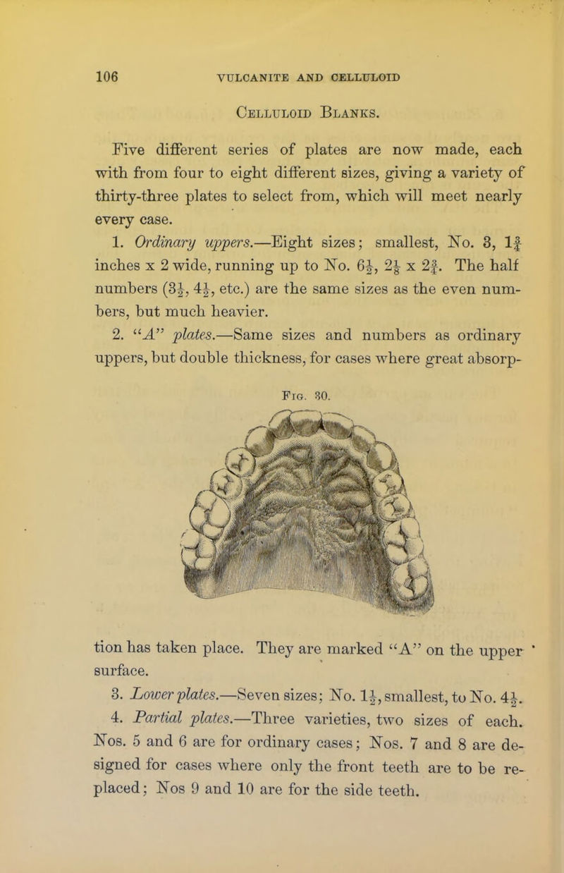 Celluloid Blanks. Five different series of plates are now made, each with from four to eight different sizes, giving a variety of thirty-three plates to select from, which will meet nearly every case. 1. Ordinary uppers.—Eight sizes; smallest, No. 3, If inches x 2 wide, running up to No. 6£, 2\ x 2f. The half numbers (3J, 4J, etc.) are the same sizes as the even num- bers, but much heavier. 2. J. plates.—Same sizes and numbers as ordinary uppers, but double thickness, for cases where great absorp- Fro. 30. tion has taken place. They are marked A on the upper ' surface. 3. Lower plates.—Seven sizes; No. 1|, smallest, to No. 4$. 4. Partial plates.—Three varieties, two sizes of each. Nos. 5 and 6 are for ordinary cases; Nos. 7 and 8 are de- signed for cases where only the front teeth are to be re- placed ; Nos 9 and 10 are for the side teeth.