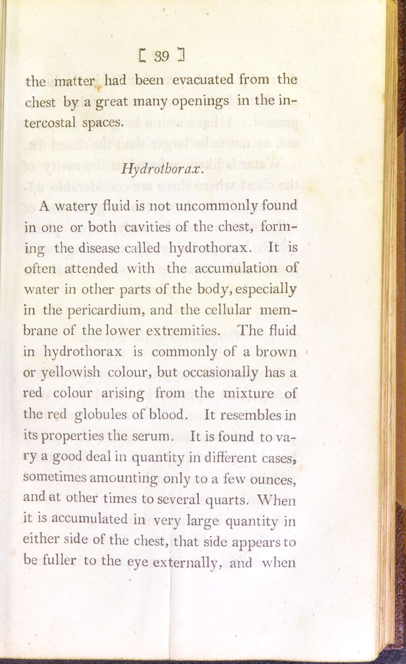 the matter had been evacuated from the chest by a great many openings in the in- tercostal spaces. Hydrothorax. A watery fluid is not uncommonly found in one or both cavities of the chest, form- ing the disease called hydrothorax. It is often attended with the accumulation of water in other parts of the body, especially in the pericardium, and the cellular mem- brane of the lower extremities. The fluid in hydrothorax is commonly of a brown or yellowish colour, but occasionally has a red colour arising from the mixture of the red globules of blood. It resembles in its properties the serum. It is found to va- ry a good deal in quantity in different cases, sometimes amounting only to a few ounces, and at other times to several quarts. When it is accumulated in very large quantity in either side of the chest, that side appears to be fuller to the eye externally, and when